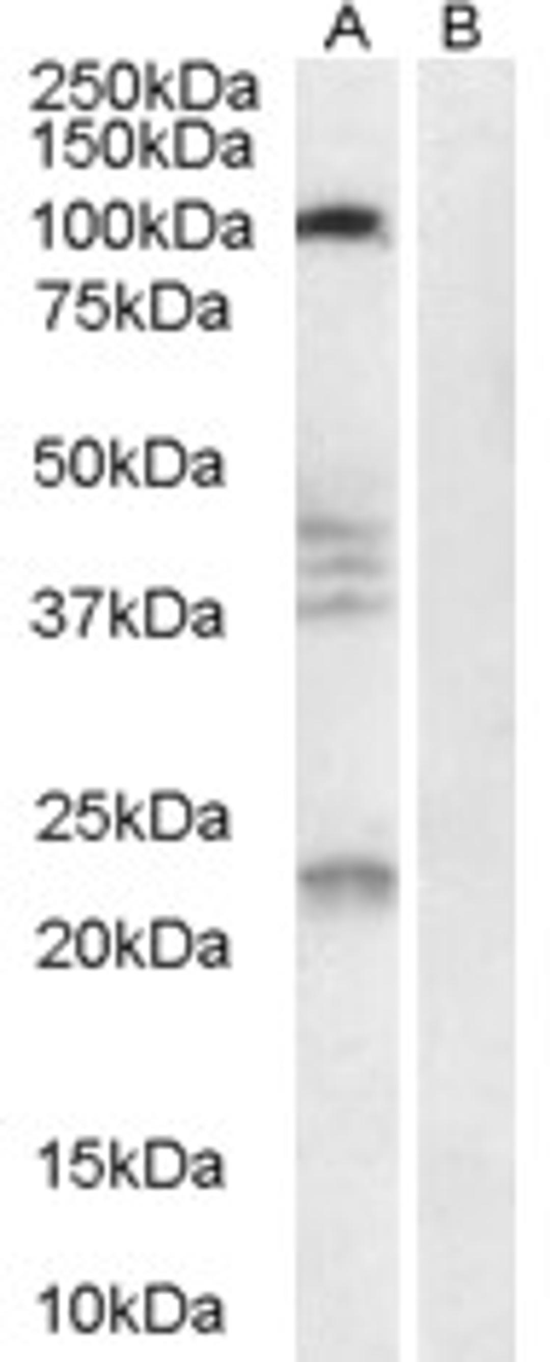 45-975 (0.3ug/ml) staining of Human Brain lysate (35ug protein in RIPA buffer) with (B) and without (A) blocking with the immunising peptide. Primary incubation was 1 hour. Detected by chemiluminescence.