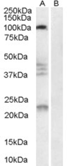 45-975 (0.3ug/ml) staining of Human Brain lysate (35ug protein in RIPA buffer) with (B) and without (A) blocking with the immunising peptide. Primary incubation was 1 hour. Detected by chemiluminescence.