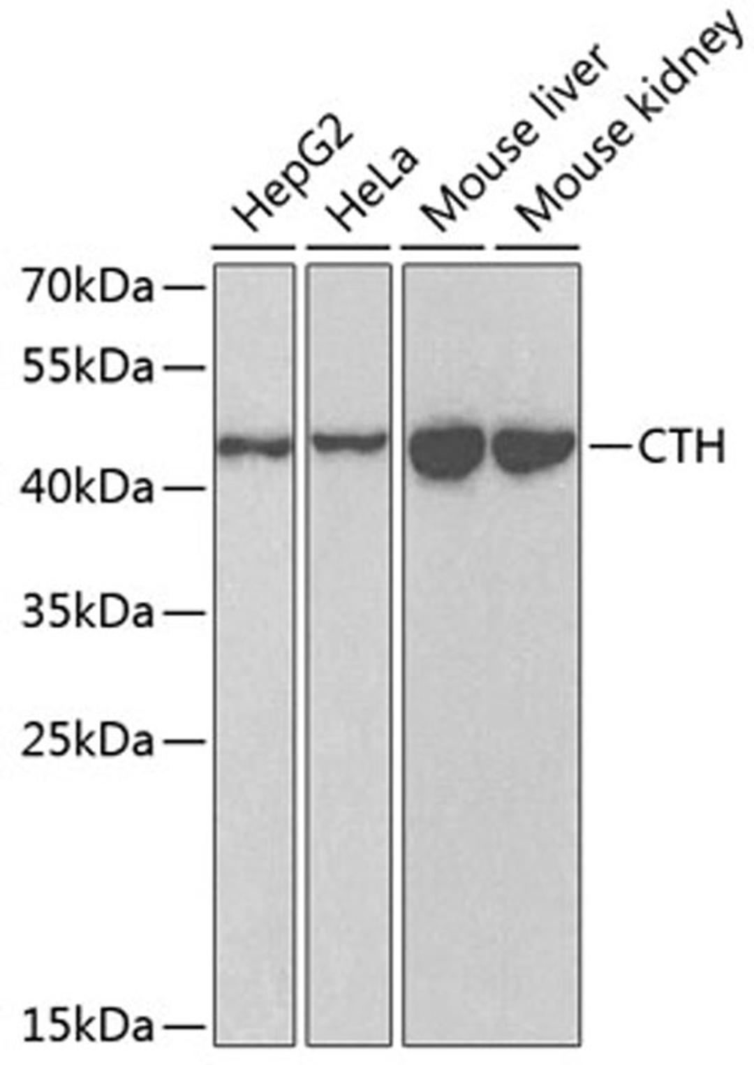 Western blot - CTH antibody (A6121)