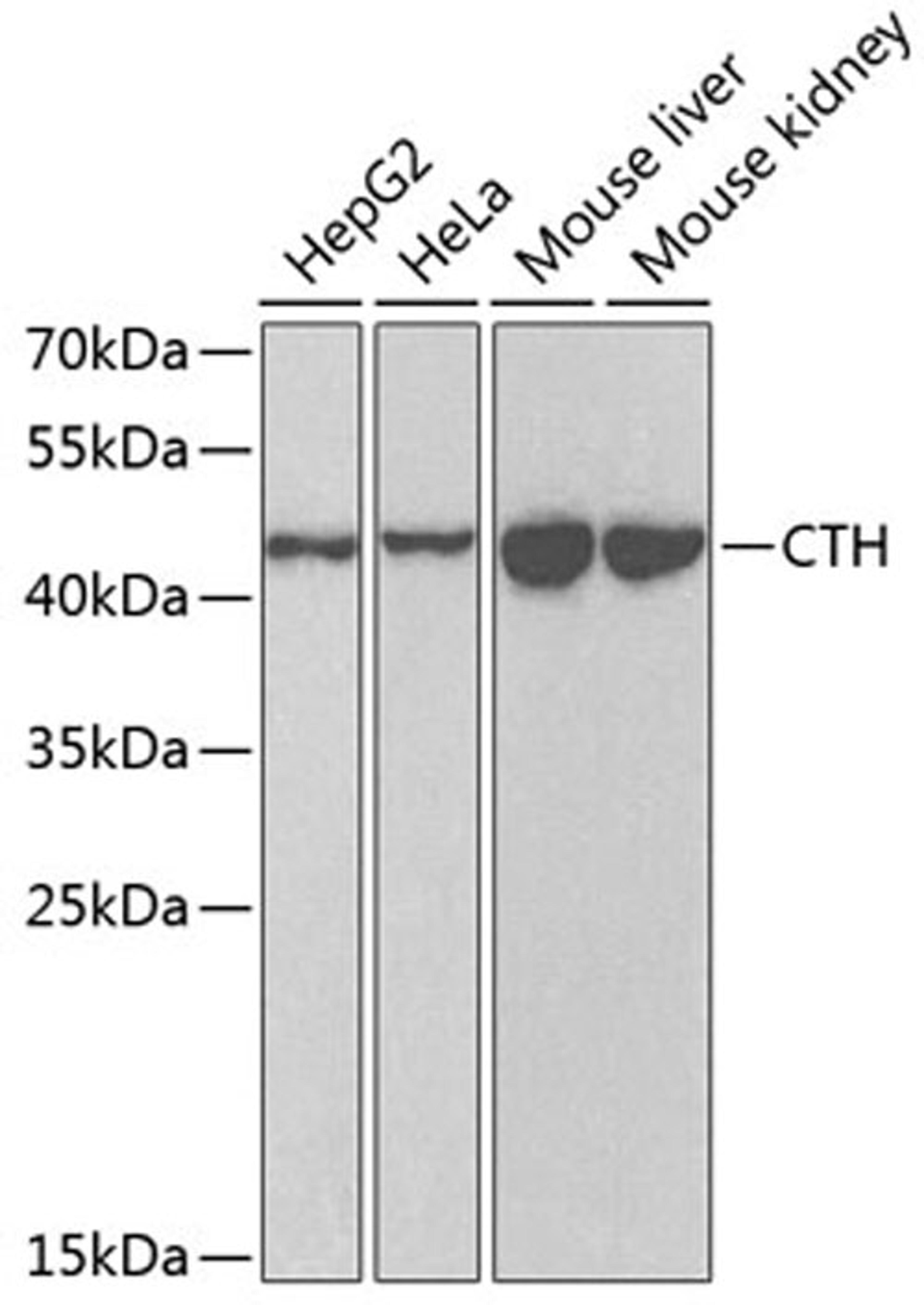 Western blot - CTH antibody (A6121)