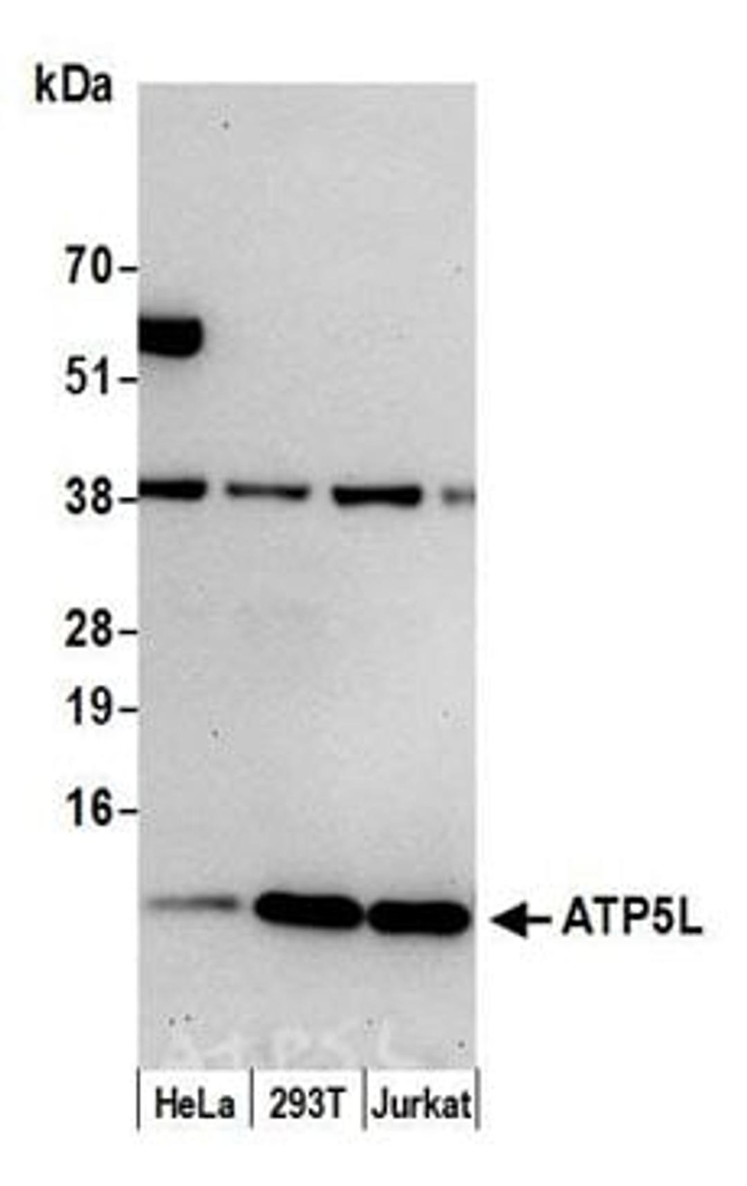 Detection of human ATP5L by western blot.