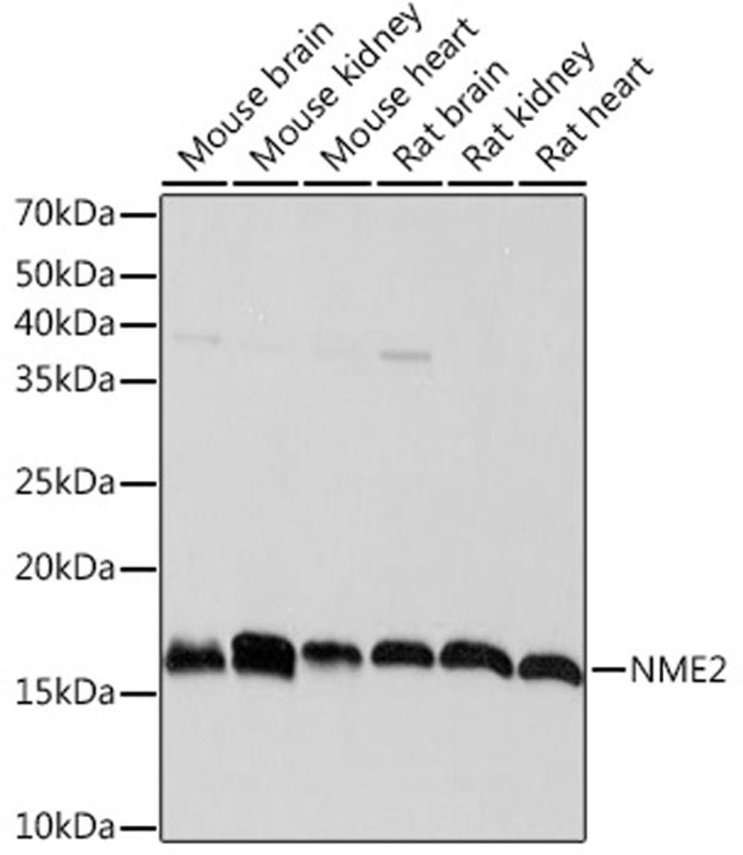 Western blot - NME2 Rabbit mAb (A5621)