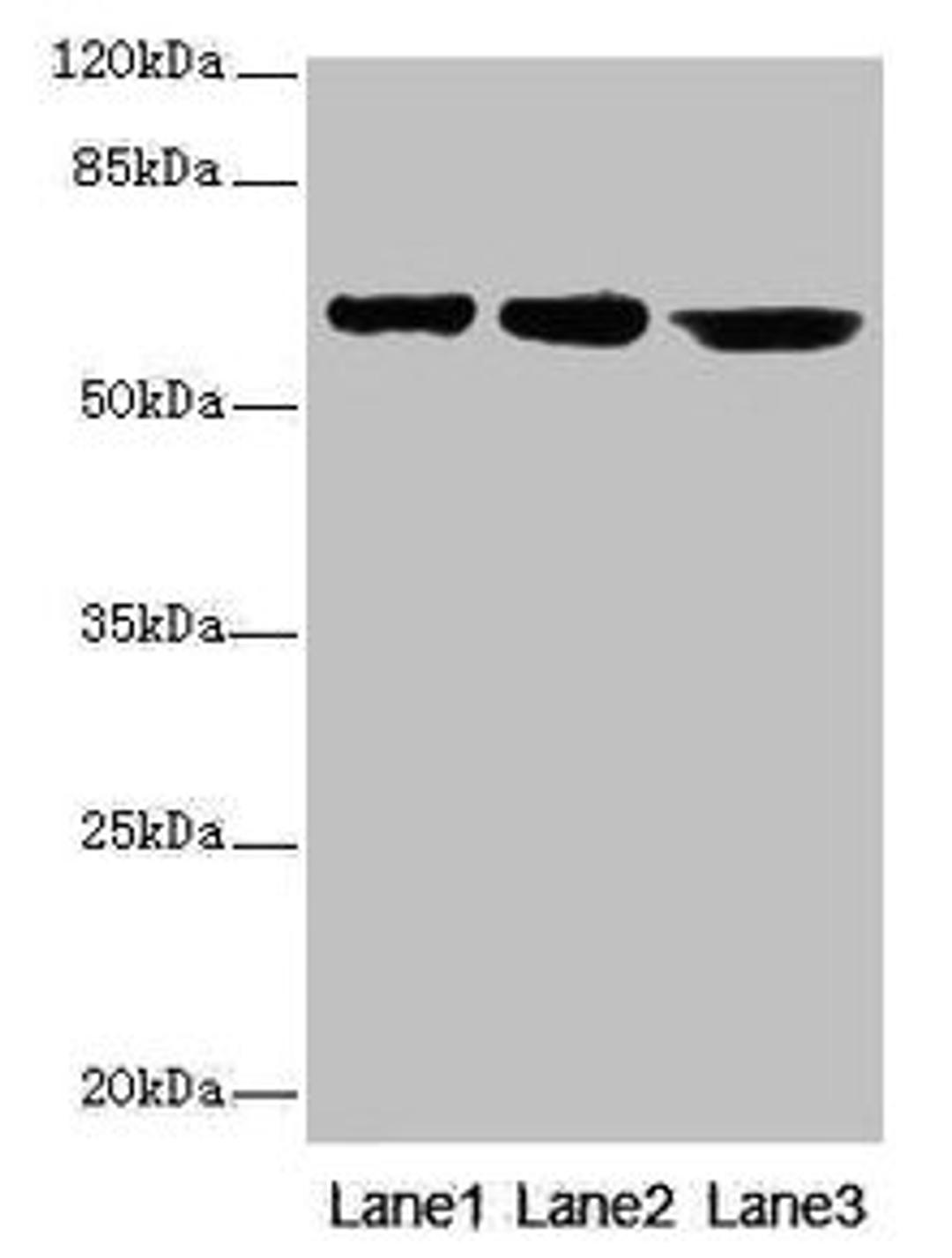 Western blot. All lanes: CATSPER2 antibody at 4µg/ml. Lane 1: Jurkat whole cell lysate. Lane 2: HepG2 whole cell lysate. Lane 3: 293T whole cell lysate. Secondary. Goat polyclonal to rabbit IgG at 1/10000 dilution. Predicted band size: 63, 62, 49, 24 kDa. Observed band size: 63 kDa