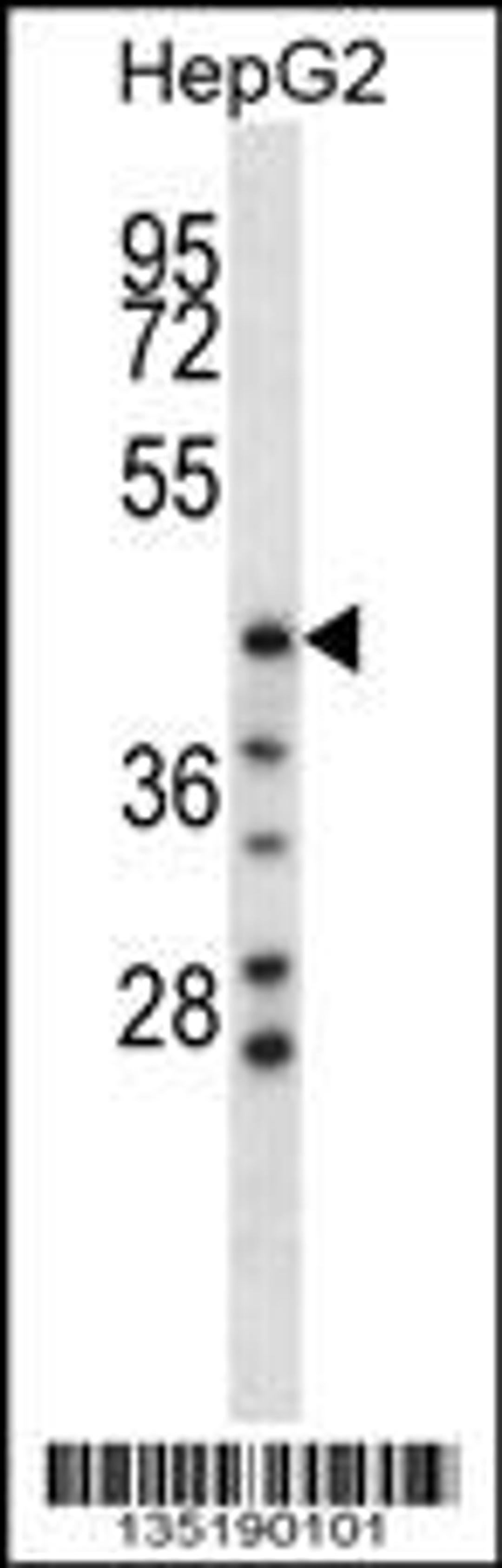 Western blot analysis in HepG2 cell line lysates (35ug/lane).