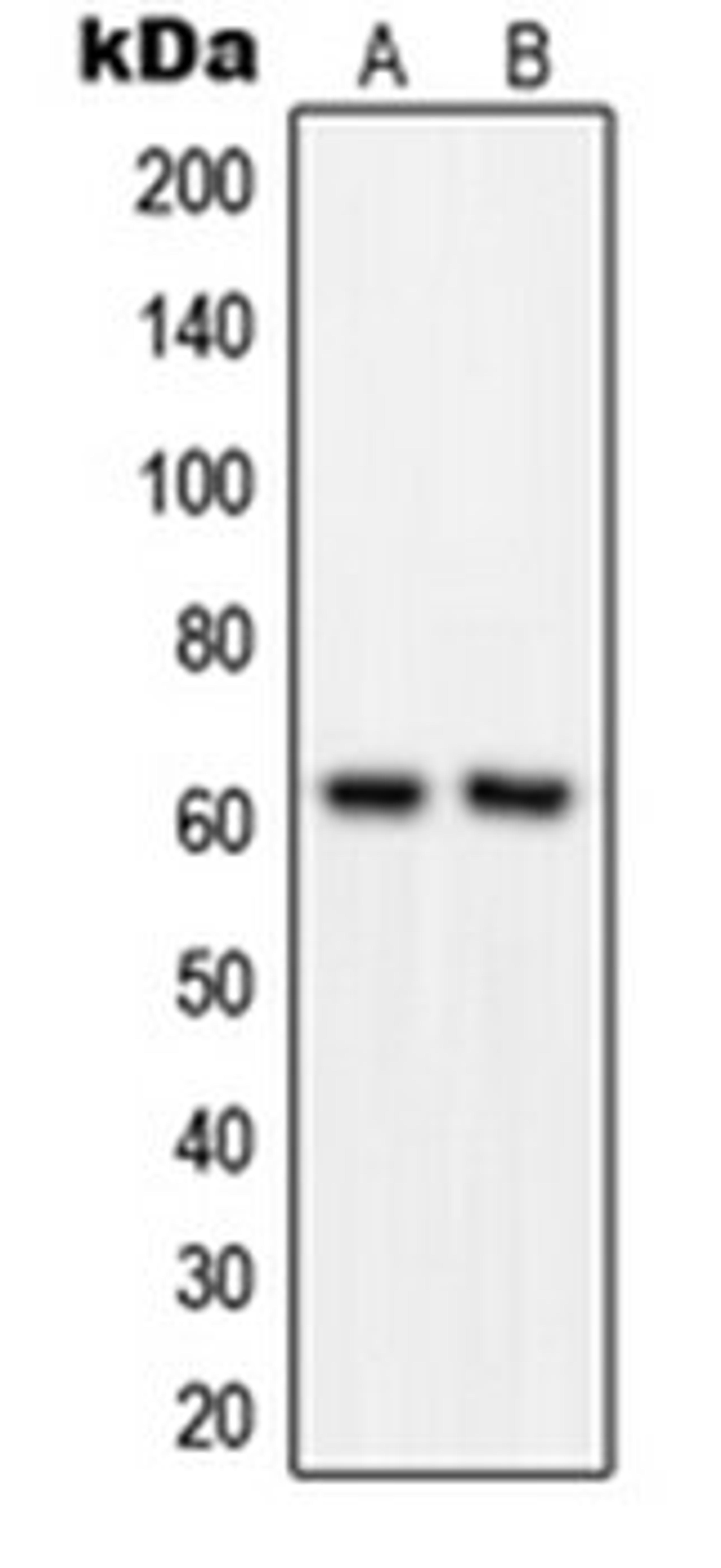 Western blot analysis of MOLT4 (Lane 1), COLO205 (Lane 2) whole cell lysates using GRB14 antibody