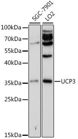 Western blot - UCP3 antibody (A1532)