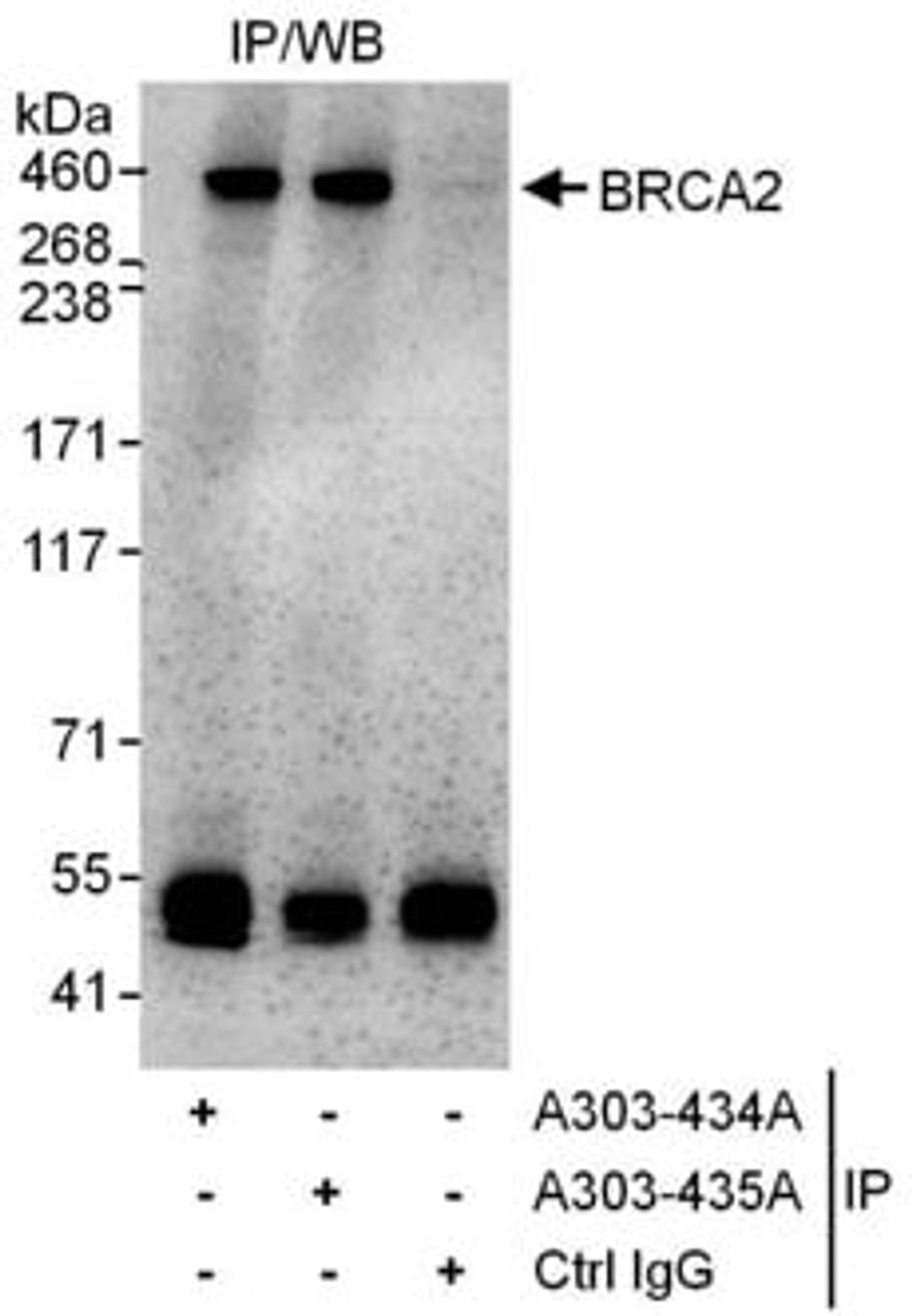 Detection of human BRCA2 by western blot of immunoprecipitates.