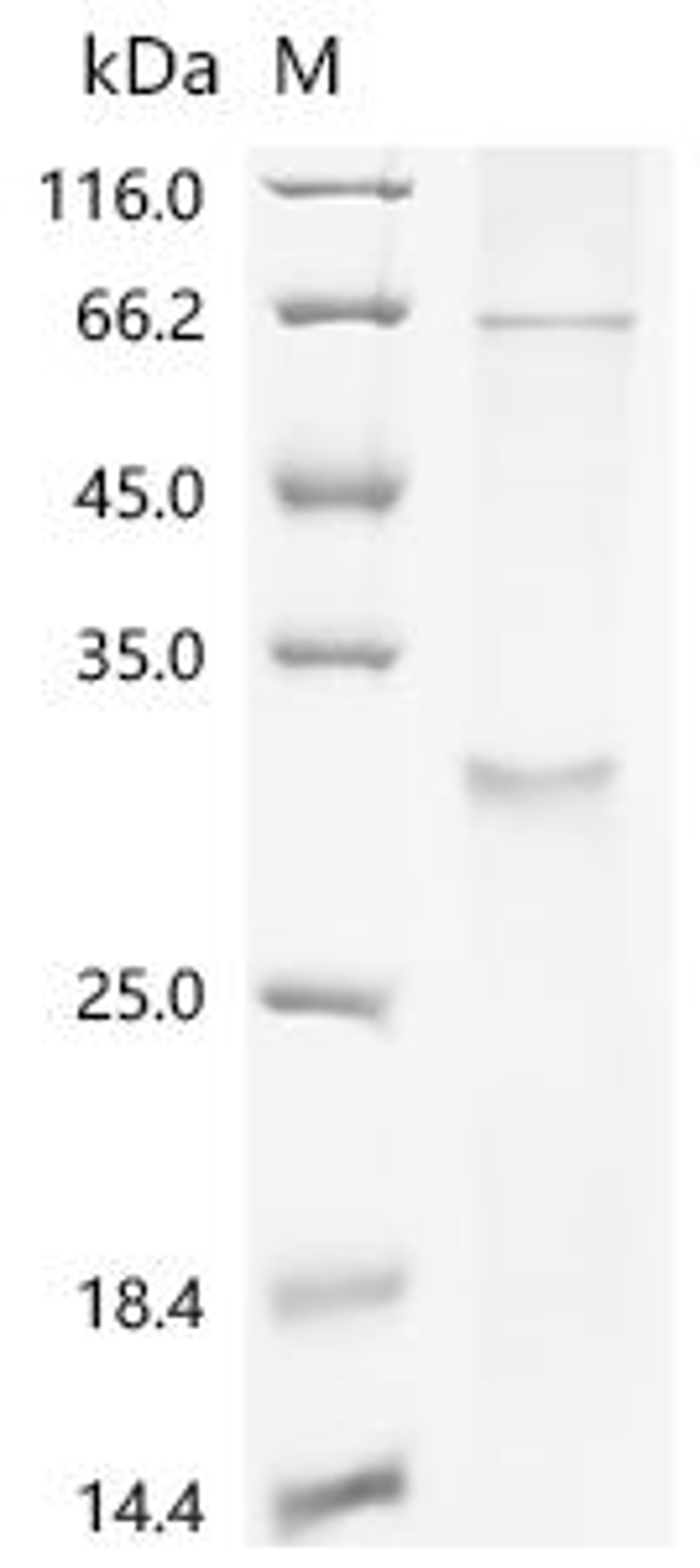(Tris-Glycine gel) Discontinuous SDS-PAGE (reduced) with 5% enrichment gel and 15% separation gel.
