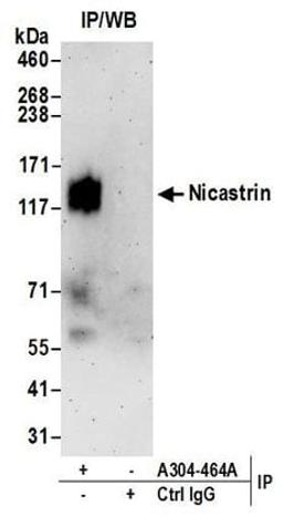 Detection of human Nicastrin by western blot of immunoprecipitates.