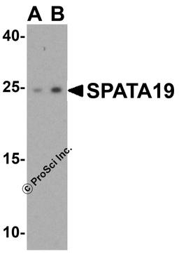 Western blot analysis of SPATA19 in human testis tissue lysate with SPATA19 antibody at (A) 1 and (B) 2 μg/mL.