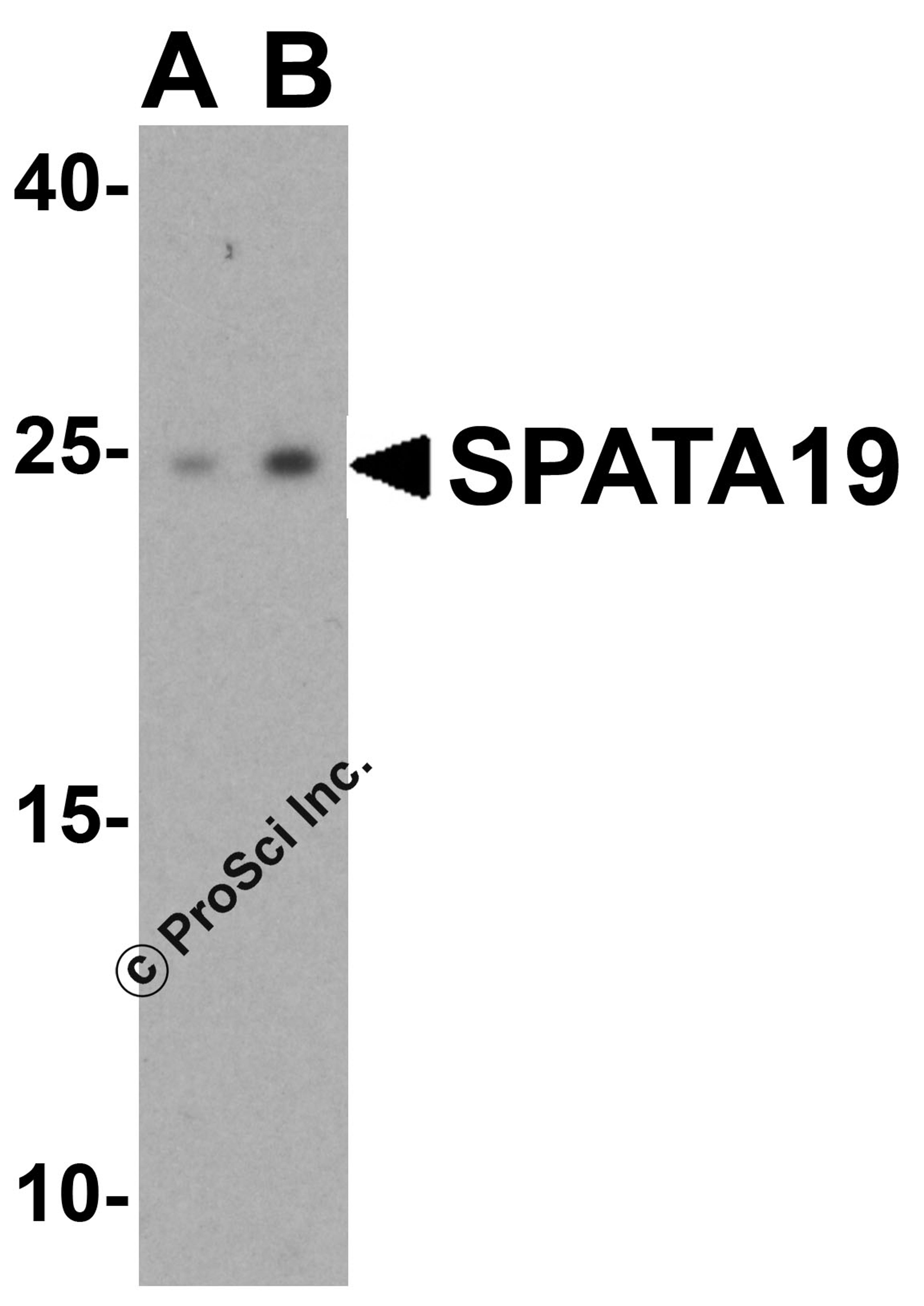 Western blot analysis of SPATA19 in human testis tissue lysate with SPATA19 antibody at (A) 1 and (B) 2 μg/mL.