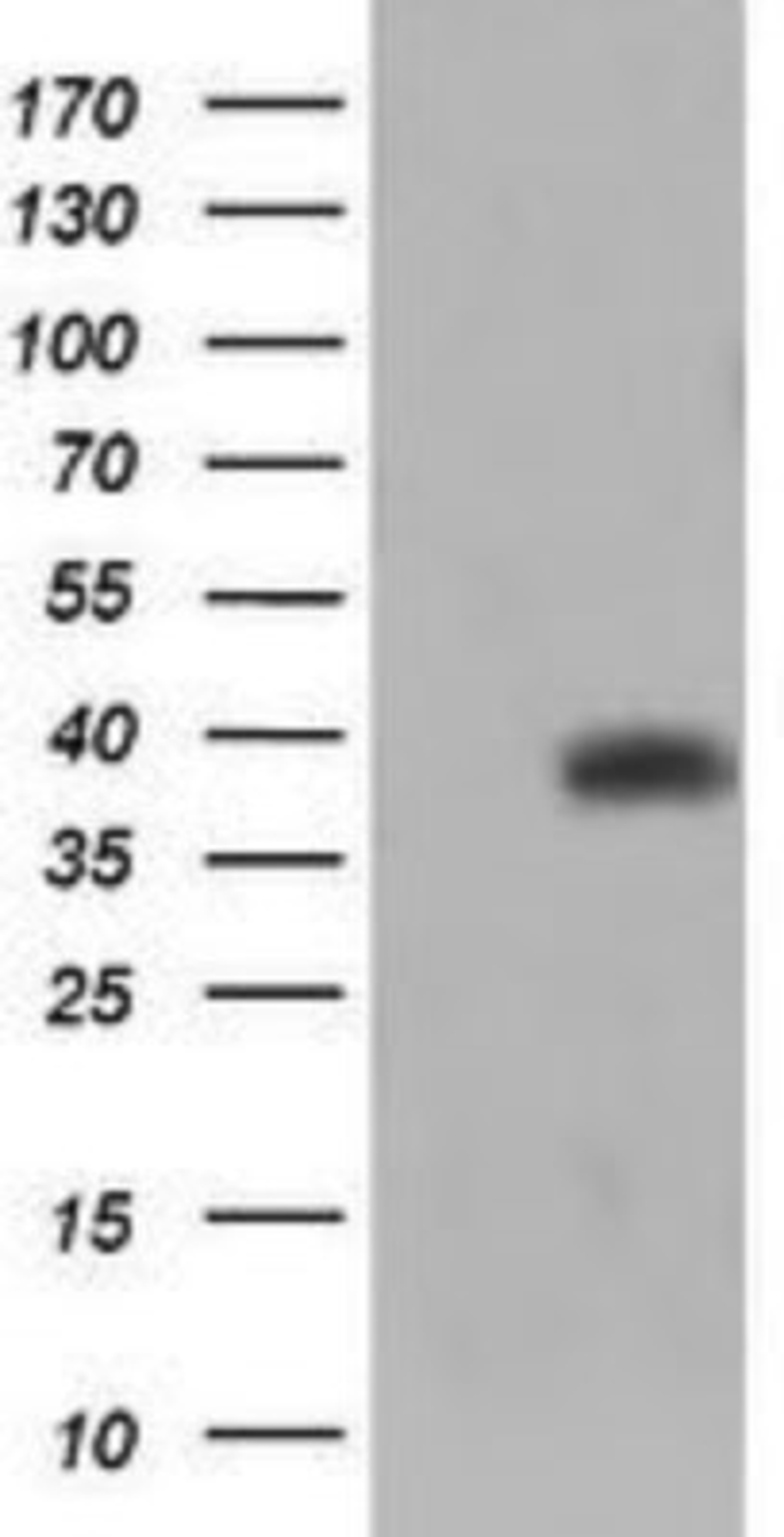 Western Blot: TRIM44 Antibody (1E10) [NBP2-46222] - Analysis of HEK293T cells were transfected with the pCMV6-ENTRY control (Left lane) or pCMV6-ENTRY TRIM44.