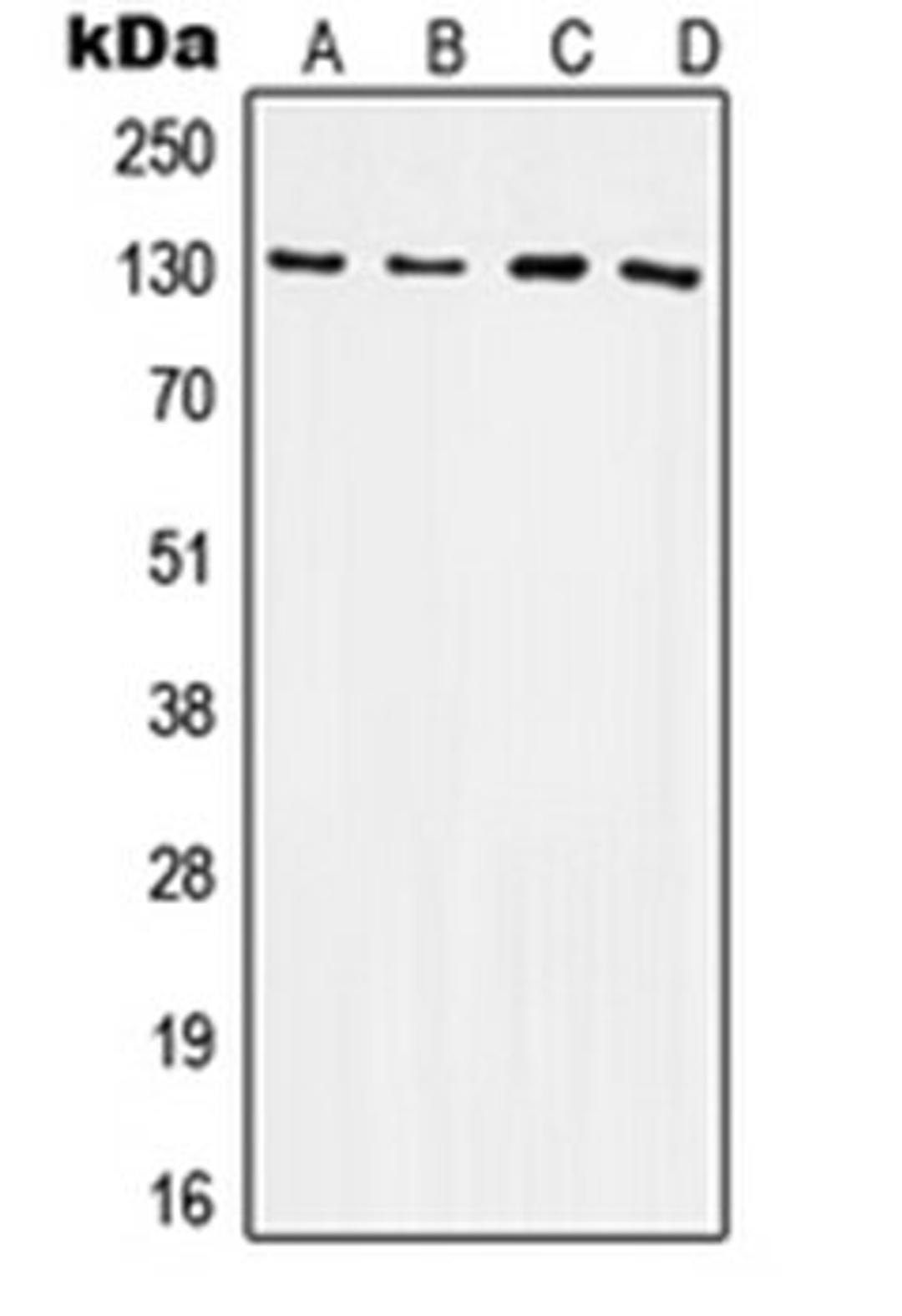 Western blot analysis of HeLa (Lane 1), Raw264.7 (Lane 2), NIH3T3 (Lane 3), H9C2 (Lane 4) whole cell lysates using ITGB3 antibody