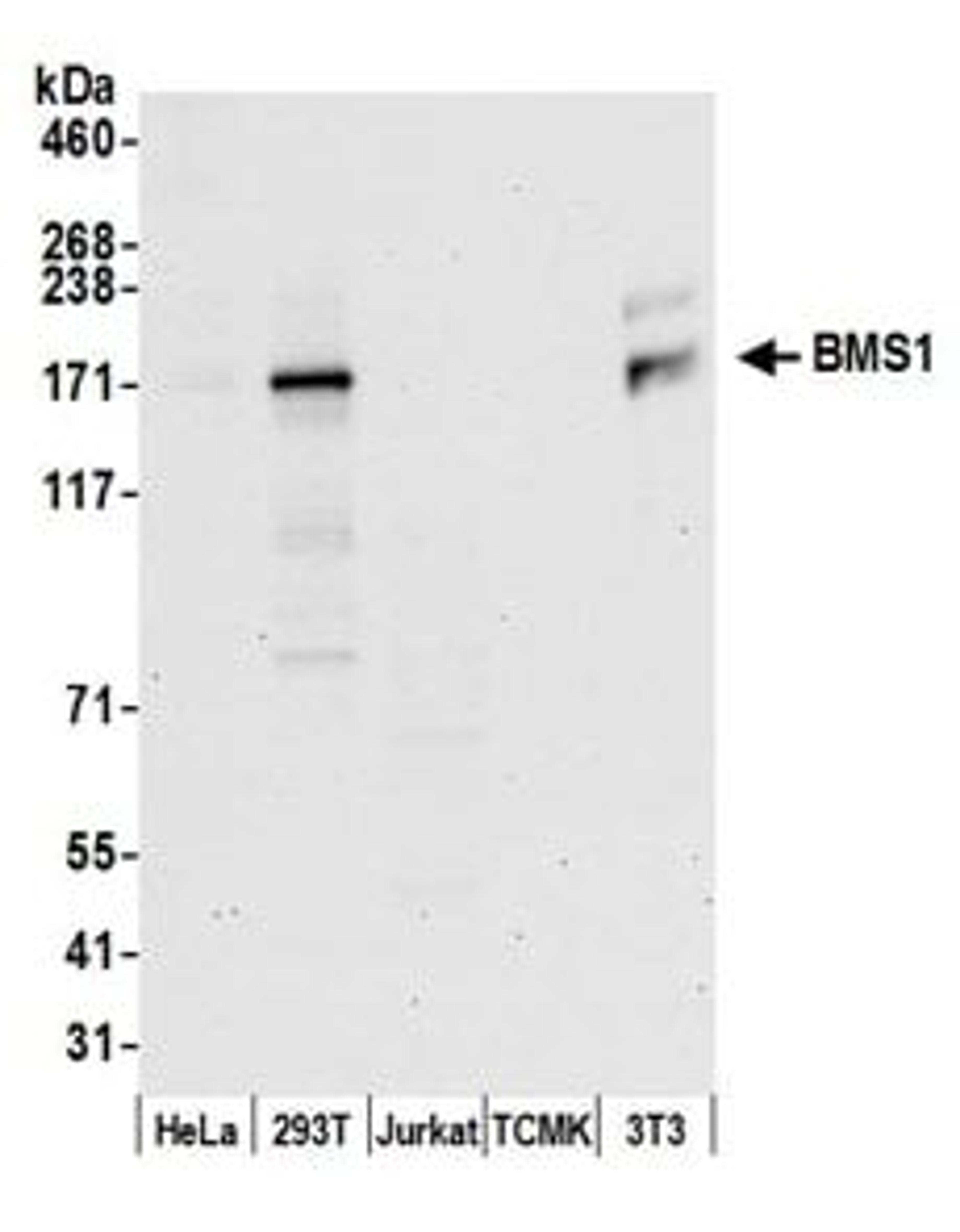 Detection of human and mouse BMS1 by western blot.