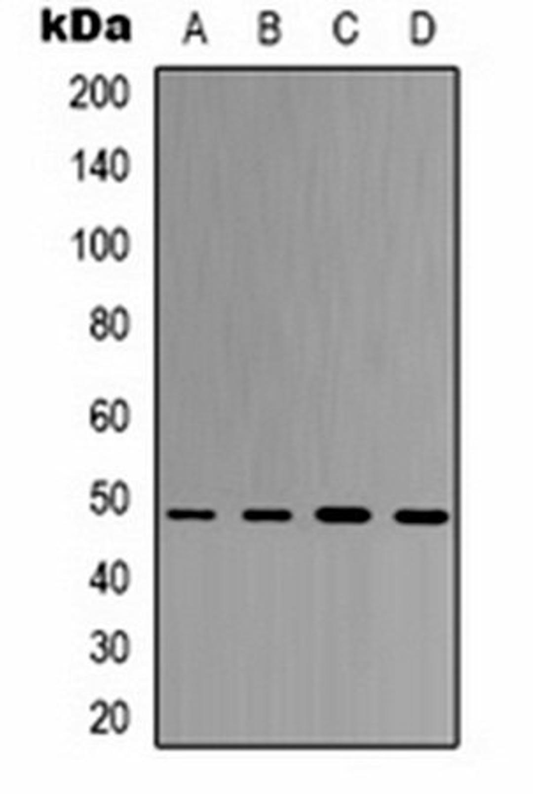 Western blot analysis of 293T (Lane 1), Hela (Lane 2), HepG2 (Lane 3), mouse brain (Lane 4) whole cell lysates using eIF4AI antibody