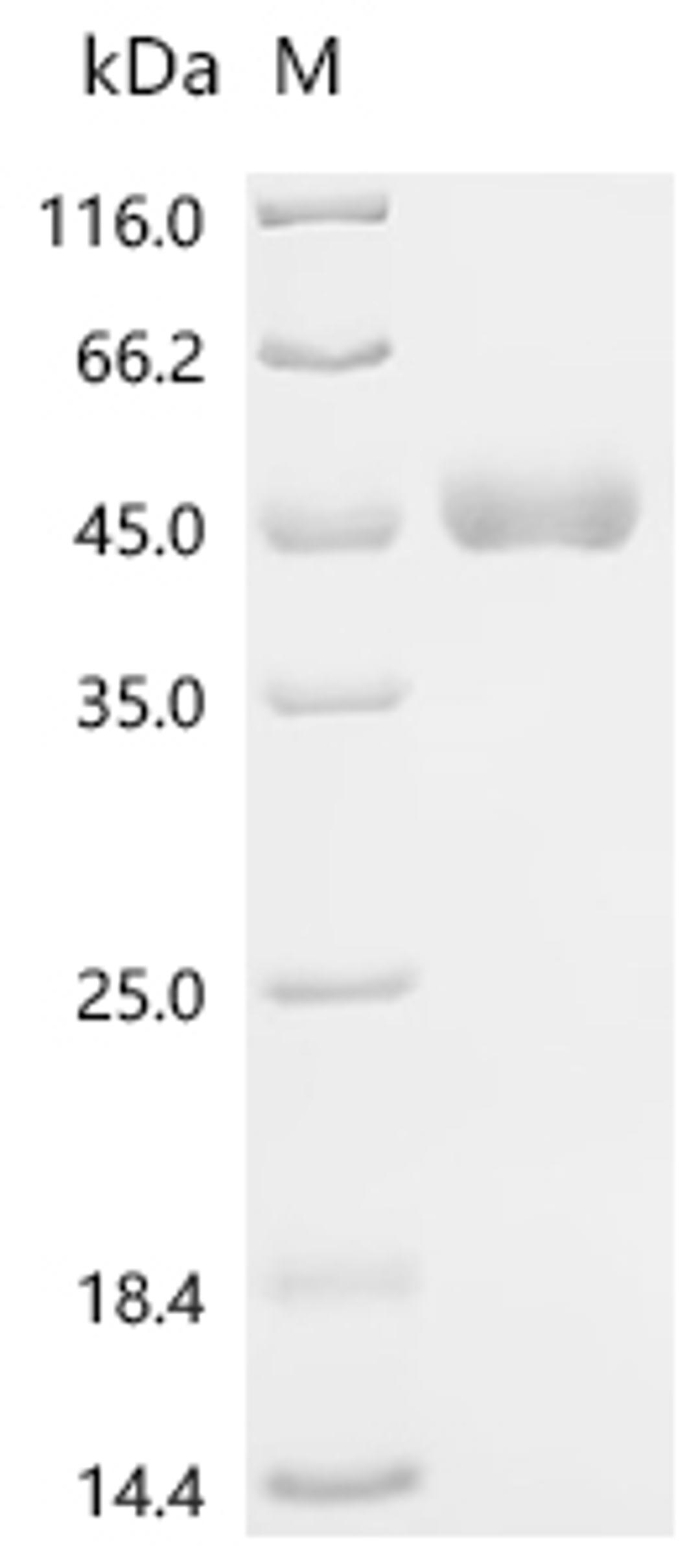 (Tris-Glycine gel) Discontinuous SDS-PAGE (reduced) with 5% enrichment gel and 15% separation gel.
