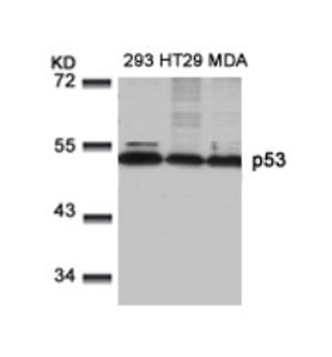 Western blot analysis of lysed extracts from 293, HT29 and MDA cells using p53 (Ab-9).