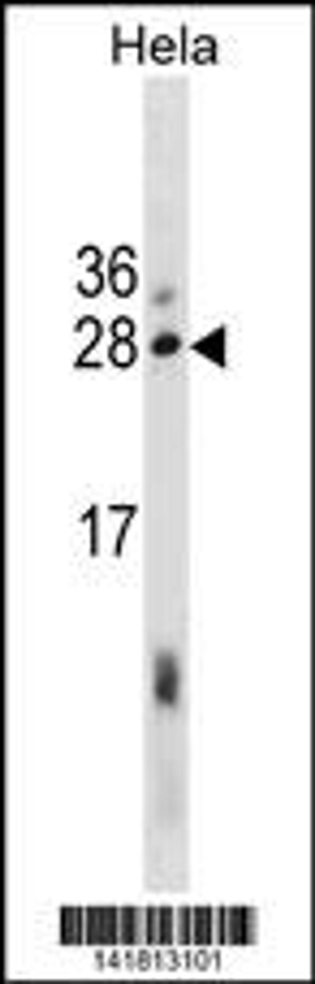 Western blot analysis in Hela cell line lysates (35ug/lane).