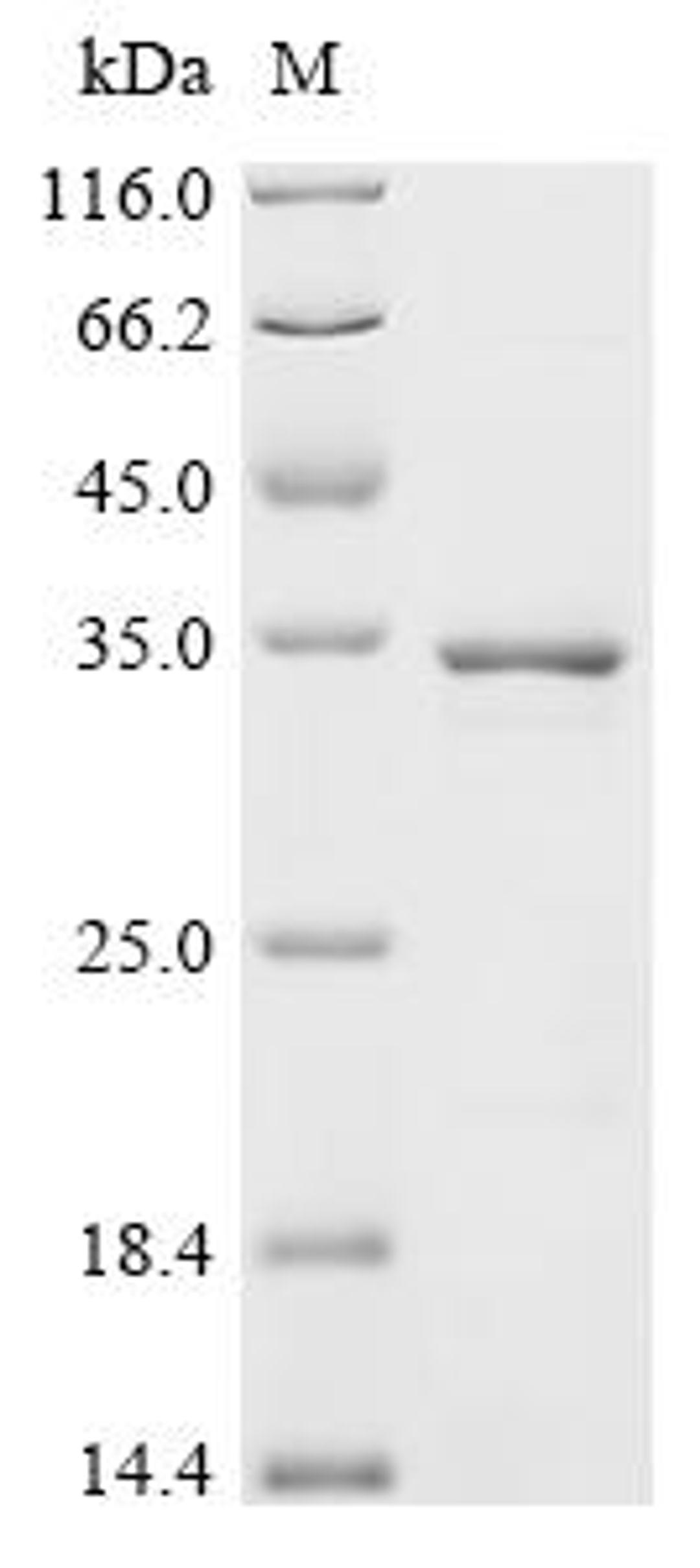 (Tris-Glycine gel) Discontinuous SDS-PAGE (reduced) with 5% enrichment gel and 15% separation gel.