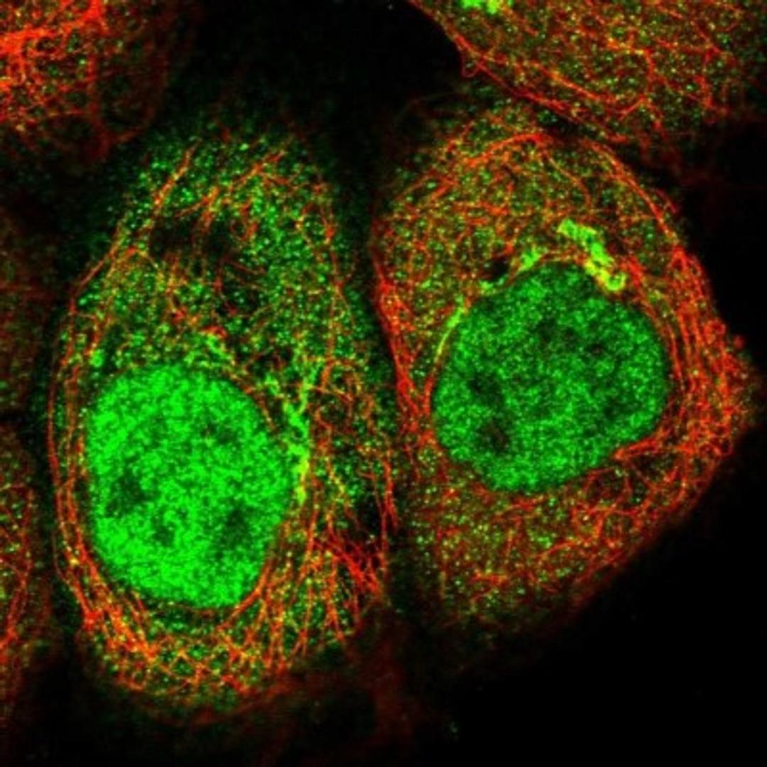 Immunocytochemistry/Immunofluorescence: AKR1CL2 Antibody [NBP1-90195] - Staining of human cell line A-431 shows positivity in nucleus but not nucleoli, cytoplasm & golgi apparatus.