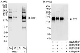 Detection of human BTF by western blot and immunoprecipitation.