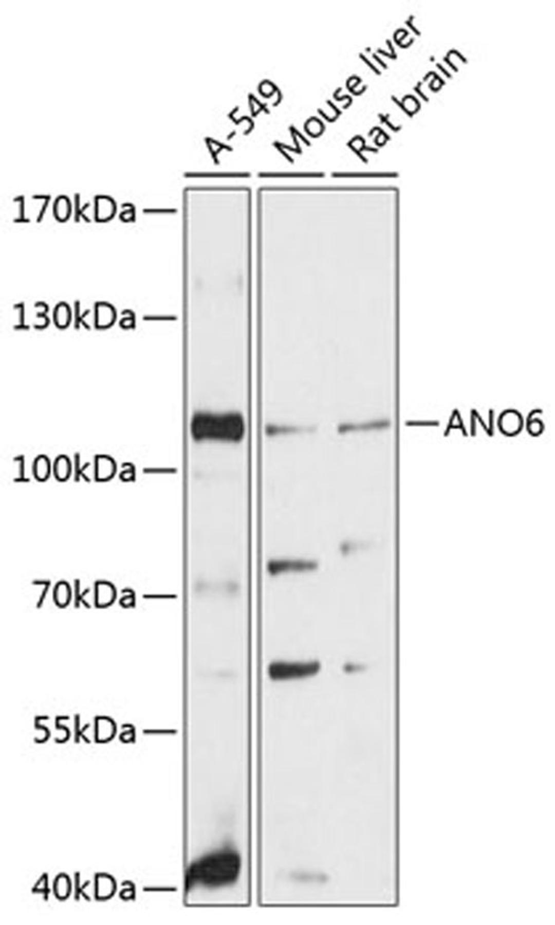 Western blot - ANO6 antibody (A12050)