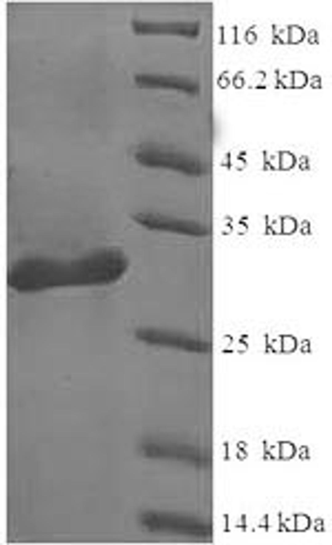 (Tris-Glycine gel) Discontinuous SDS-PAGE (reduced) with 5% enrichment gel and 15% separation gel.