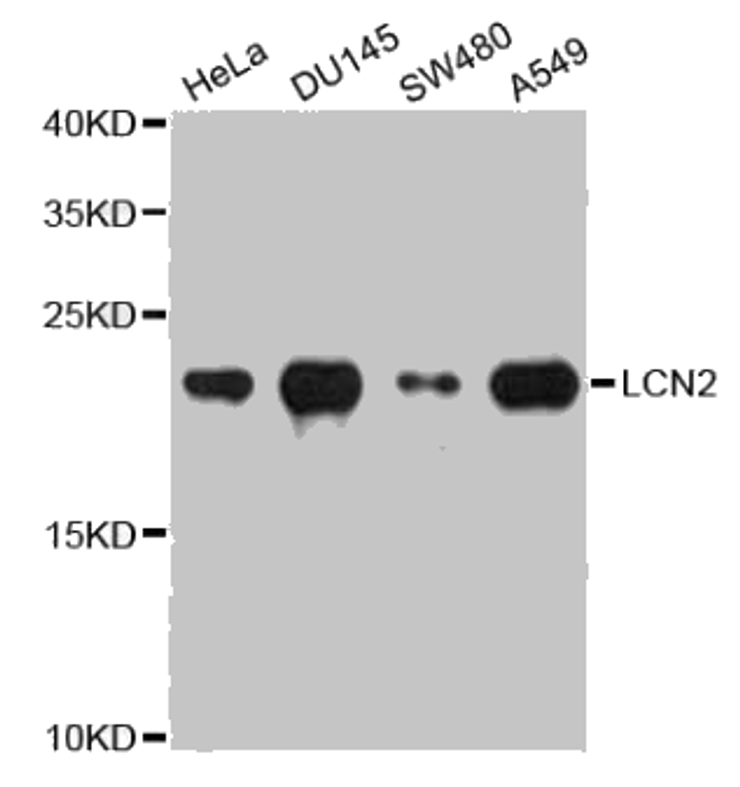 Western blot analysis of extracts of various cell lines, using LCN2 antibody