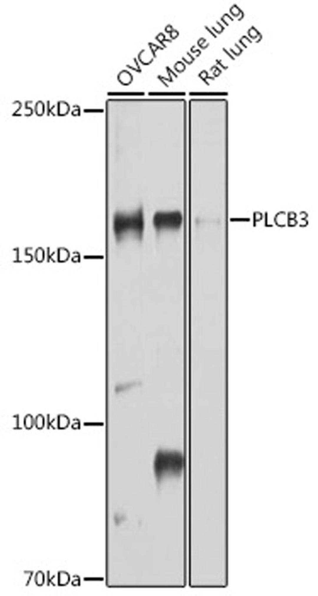 Western blot - PLCB3 antibody (A10236)