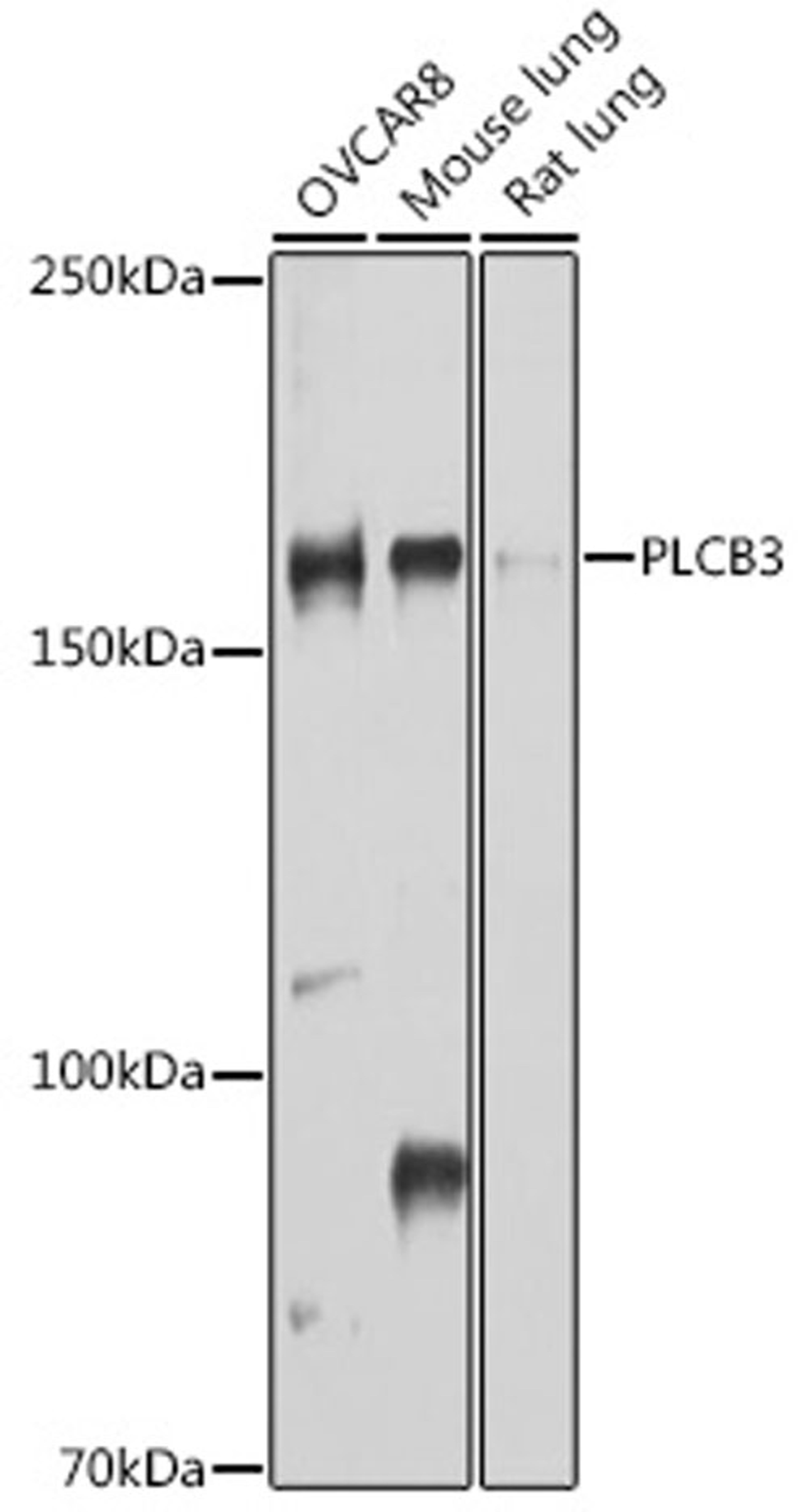 Western blot - PLCB3 antibody (A10236)