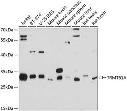 Western blot - TRMT61A antibody (A10597)