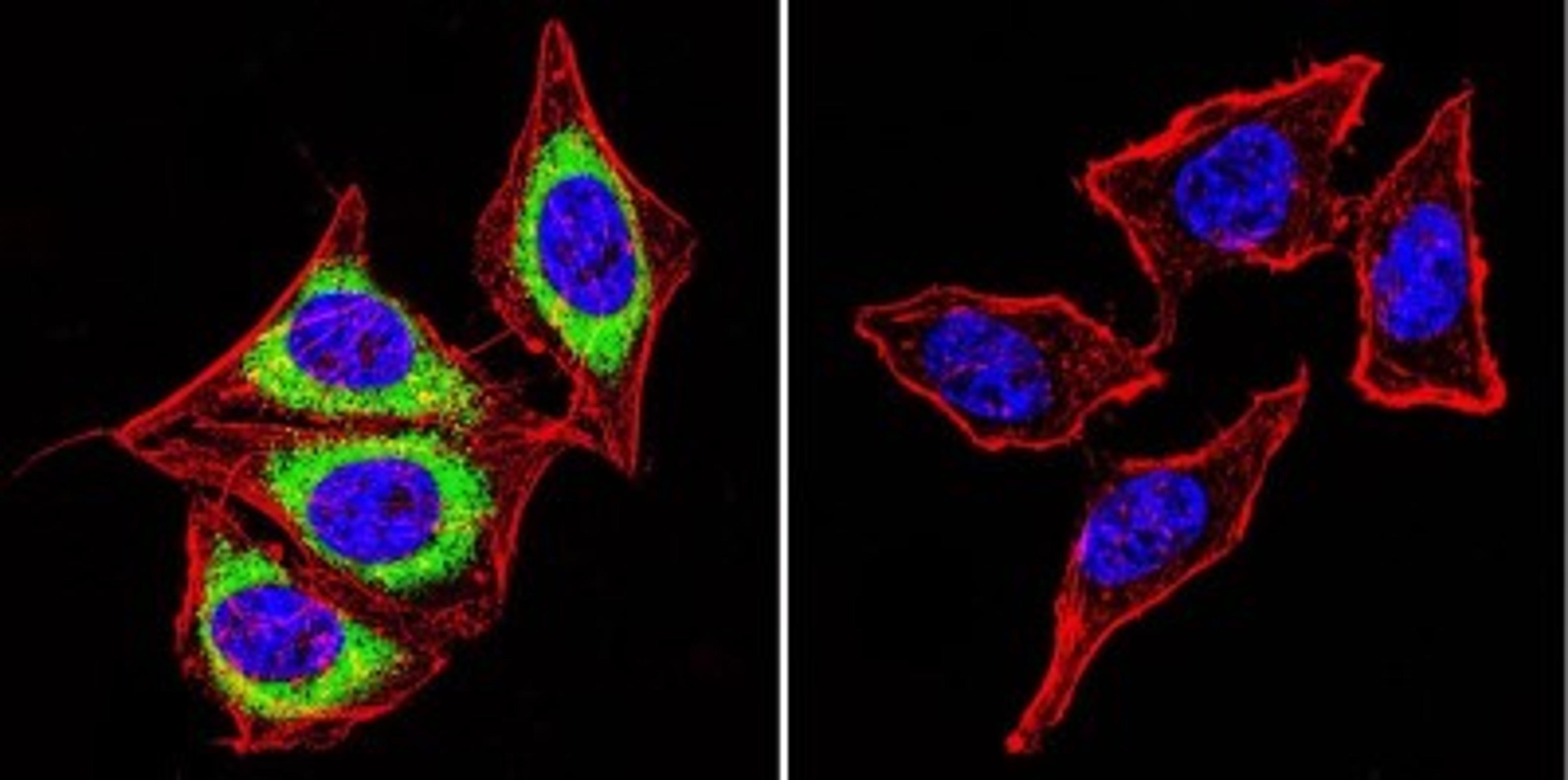 Immunocytochemistry/Immunofluorescence: Calsequestrin 1 Antibody (VIIID12) [NB120-2824] - Calsequestrin staining (green), F-Actin staining with Phalloidin (red) and nuclei with DAPI (blue) is shown. Cells were grown on chamber slides and fixed with formaldehyde prior to staining. Cells were probed without (control) or with or an antibody recognizing Calsequestrin at a dilution of 1:100 over night at 4C, washed with PBS and incubated with a DyLight-488 conjugated.