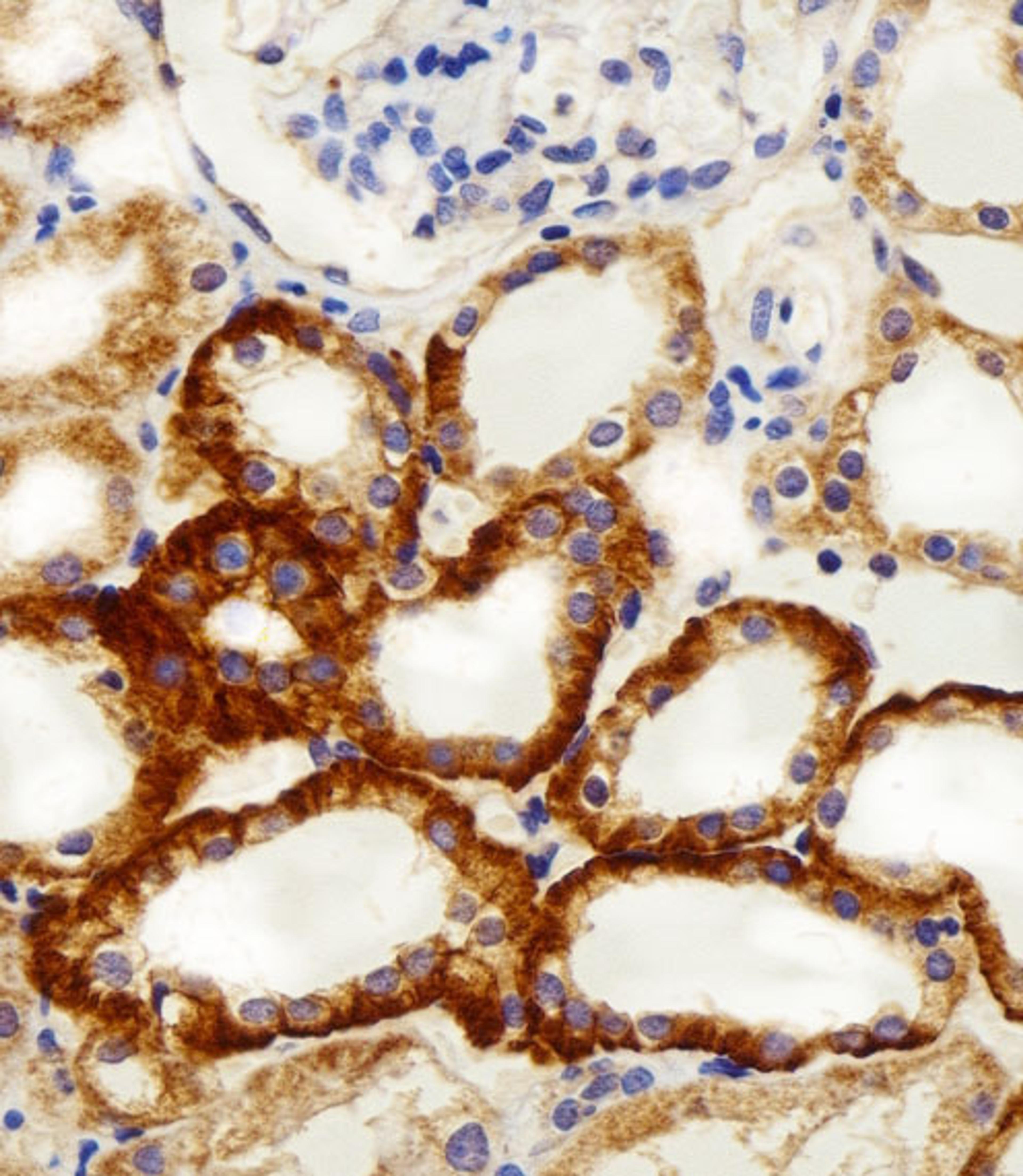 Immunohistochemical analysis of paraffin-embedded H. kidney section using NDUFC2 Antibody (N-term). Antibody was diluted at 1:100 dilution. A peroxidase-conjugated goat anti-rabbit IgG at 1:400 dilution was used as the secondary antibody, followed by DAB 