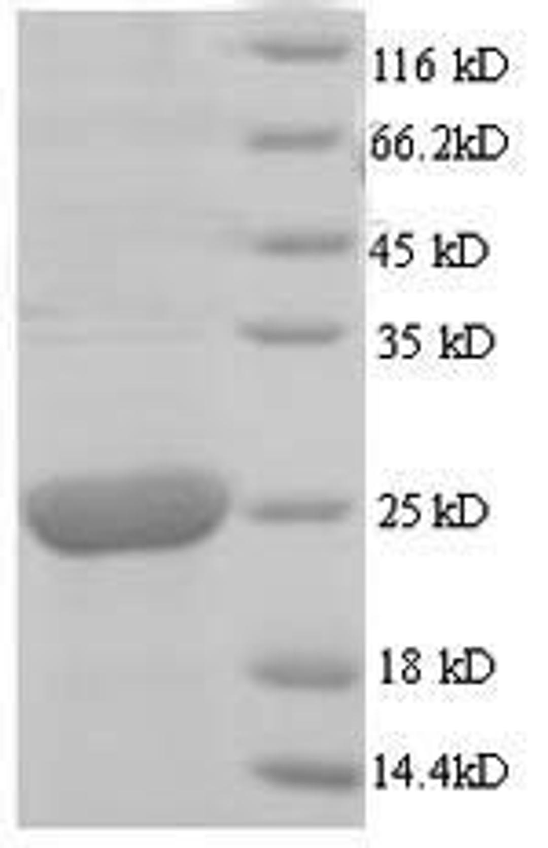 (Tris-Glycine gel) Discontinuous SDS-PAGE (reduced) with 5% enrichment gel and 15% separation gel.