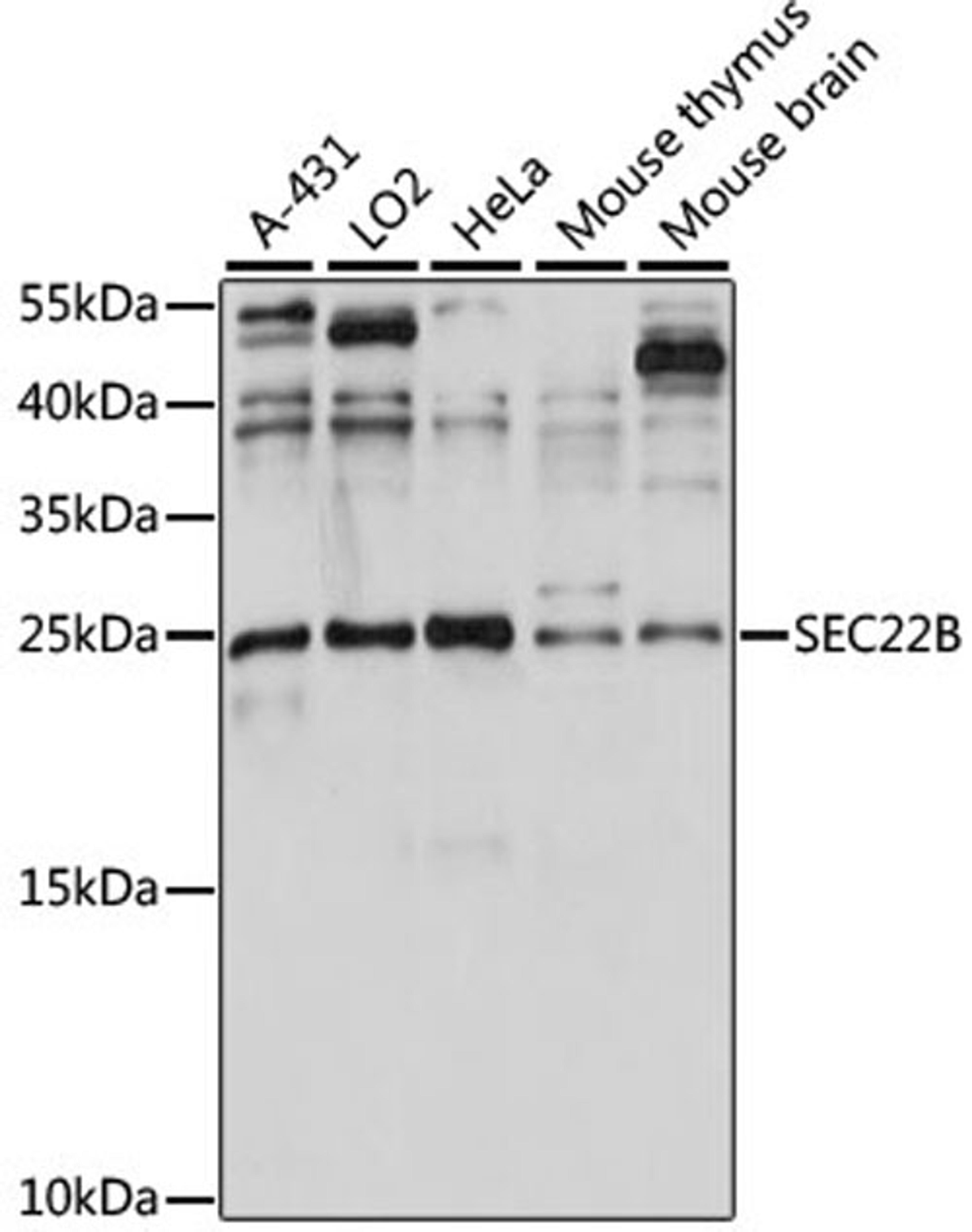 Western blot - SEC22B antibody (A15358)