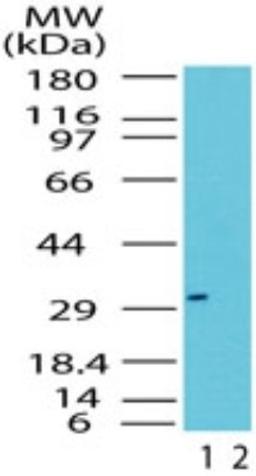 Western Blot: RAX Antibody [NB100-56467] - analysis of Rax in the 1) absence and 2) presence of immunizing peptide in Jurkat cell lysate using this antibody. 5 ug/ml.