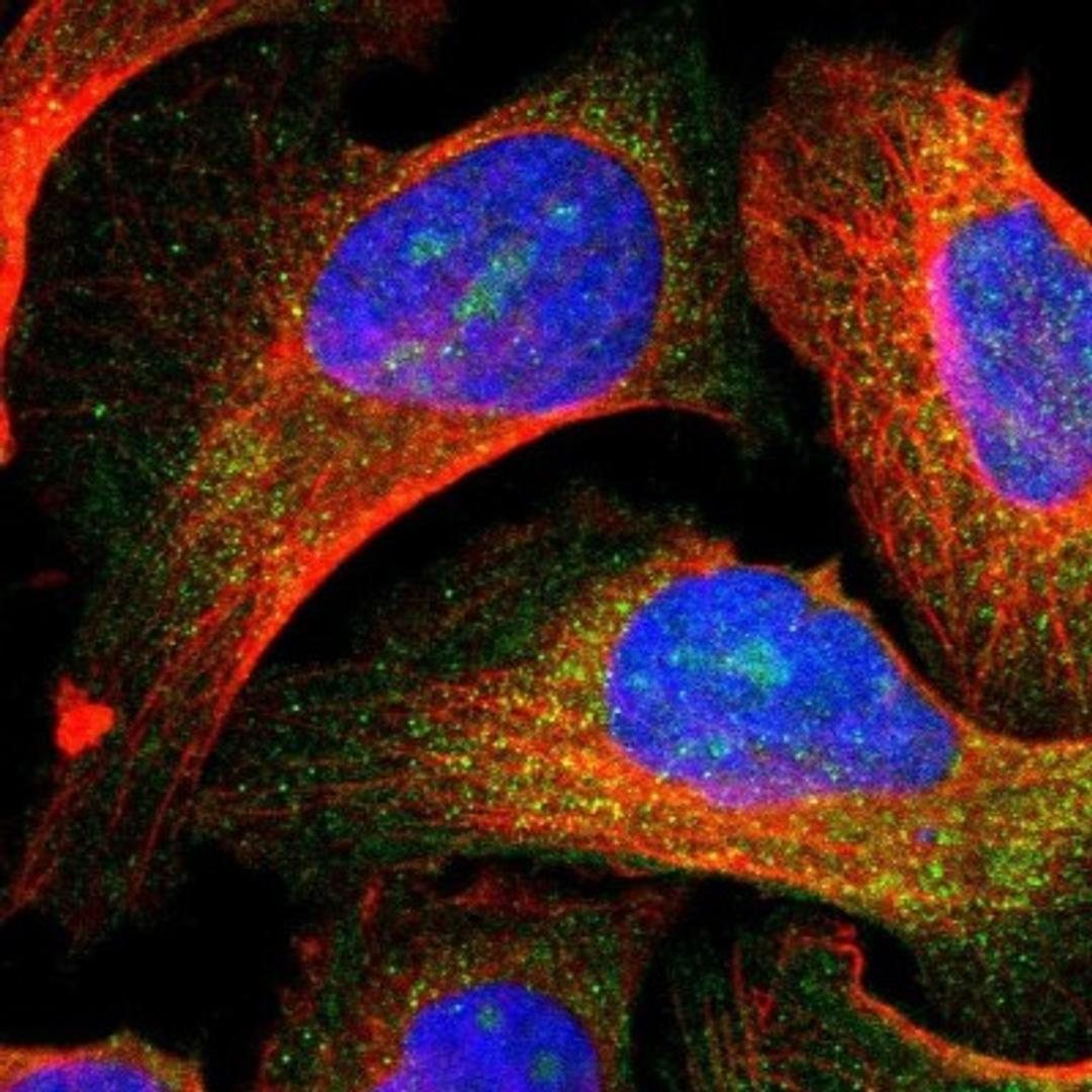 Immunocytochemistry/Immunofluorescence: AGBL2 Antibody [NBP1-83581] - Staining of human cell line U-2 OS shows positivity in nucleoli & cytoplasm.