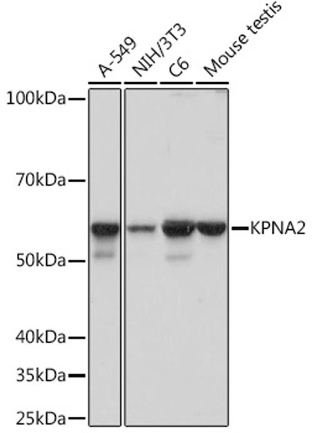 Western blot - KPNA2 Rabbit mAb (A5012)