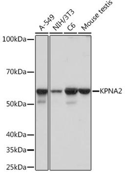 Western blot - KPNA2 Rabbit mAb (A5012)