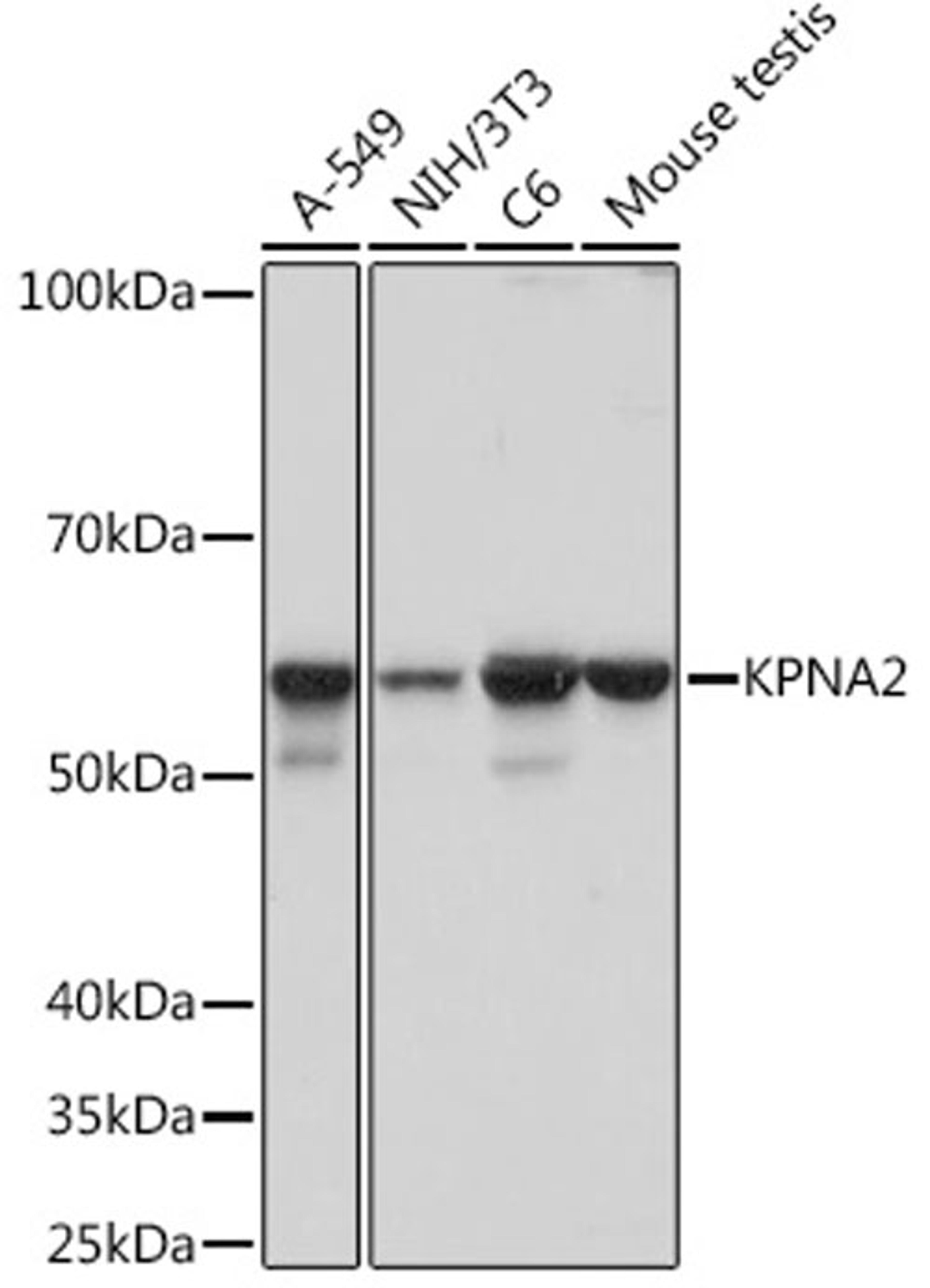 Western blot - KPNA2 Rabbit mAb (A5012)