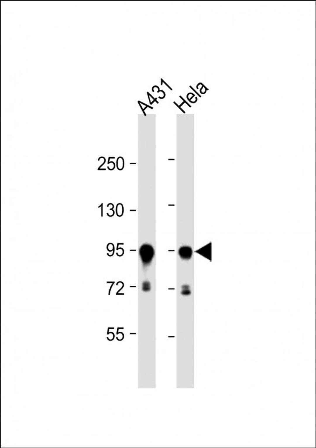 Western Blot at 1:1000 dilution Lane 1: A431 whole cell lysate Lane 2: Hela whole cell lysate Lysates/proteins at 20 ug per lane.