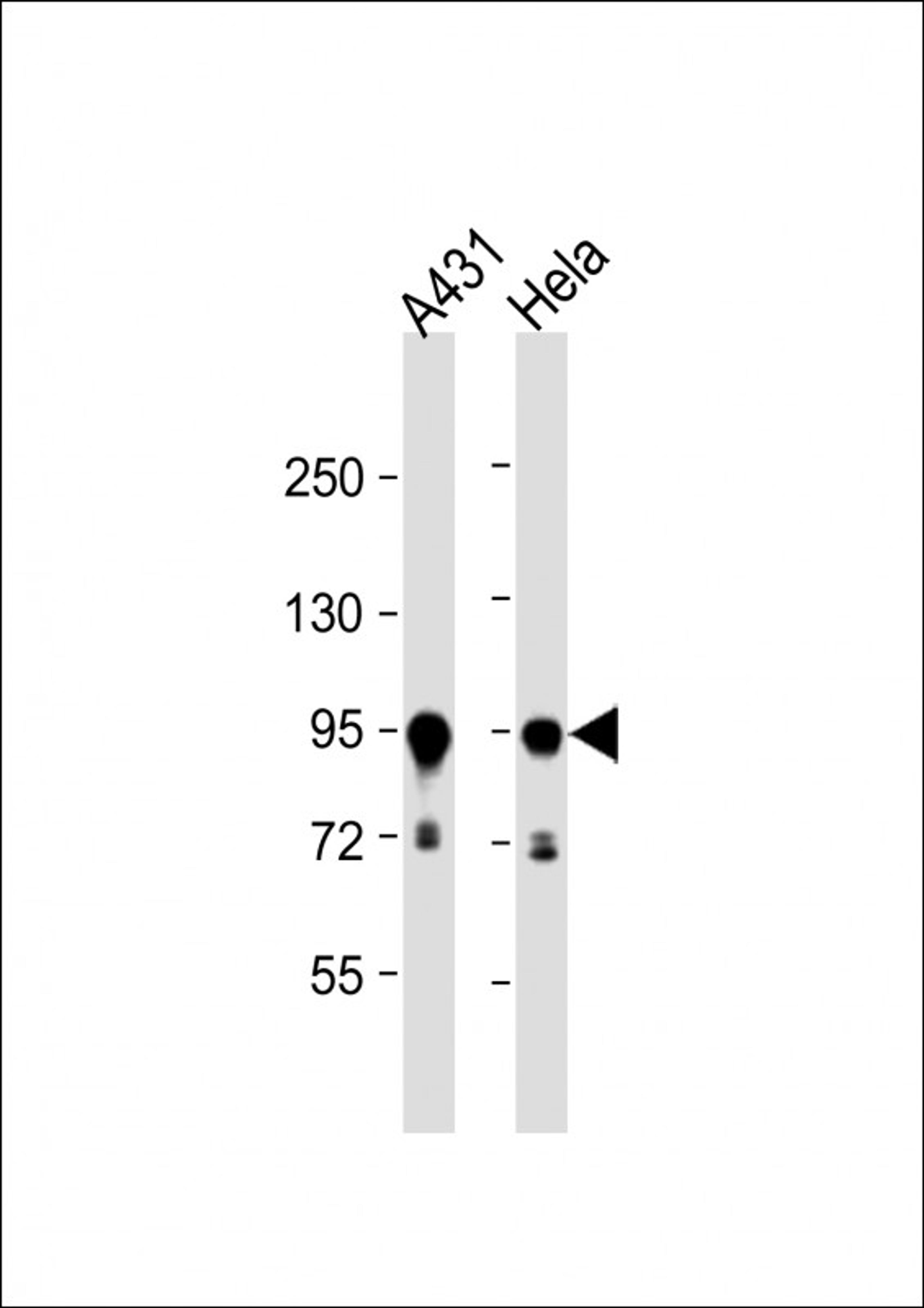 Western Blot at 1:1000 dilution Lane 1: A431 whole cell lysate Lane 2: Hela whole cell lysate Lysates/proteins at 20 ug per lane.