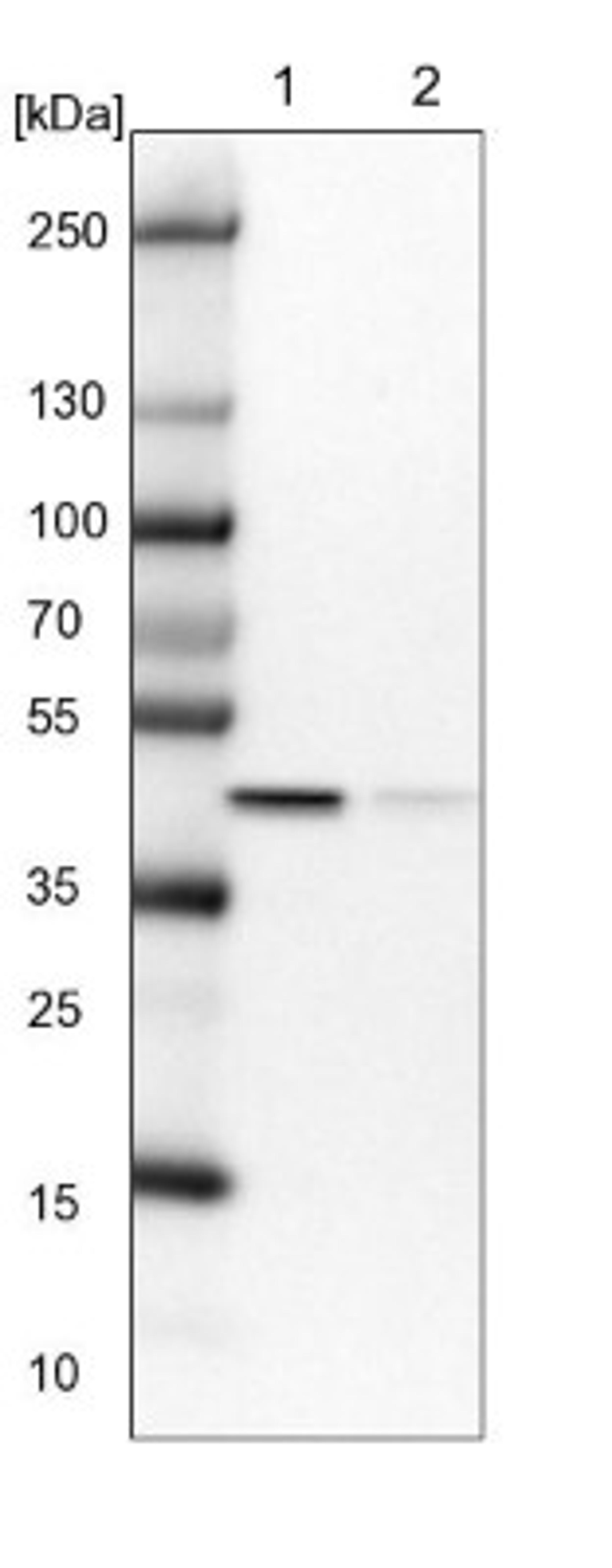 Western Blot: GTPBP9 Antibody [NBP1-89725] - Lane 1: NIH-3T3 cell lysate (Mouse embryonic fibroblast cells)<br/>Lane 2: NBT-II cell lysate (Rat Wistar bladder tumour cells)