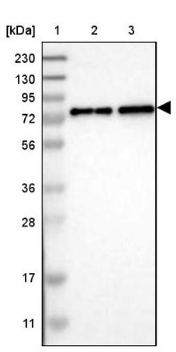 Western Blot: CACNB4 Antibody [NBP1-83984] - Lane 1: Marker [kDa] 230, 130, 95, 72, 56, 36, 28, 17, 11<br/>Lane 2: Human cell line RT-4<br/>Lane 3: Human cell line U-251MG sp