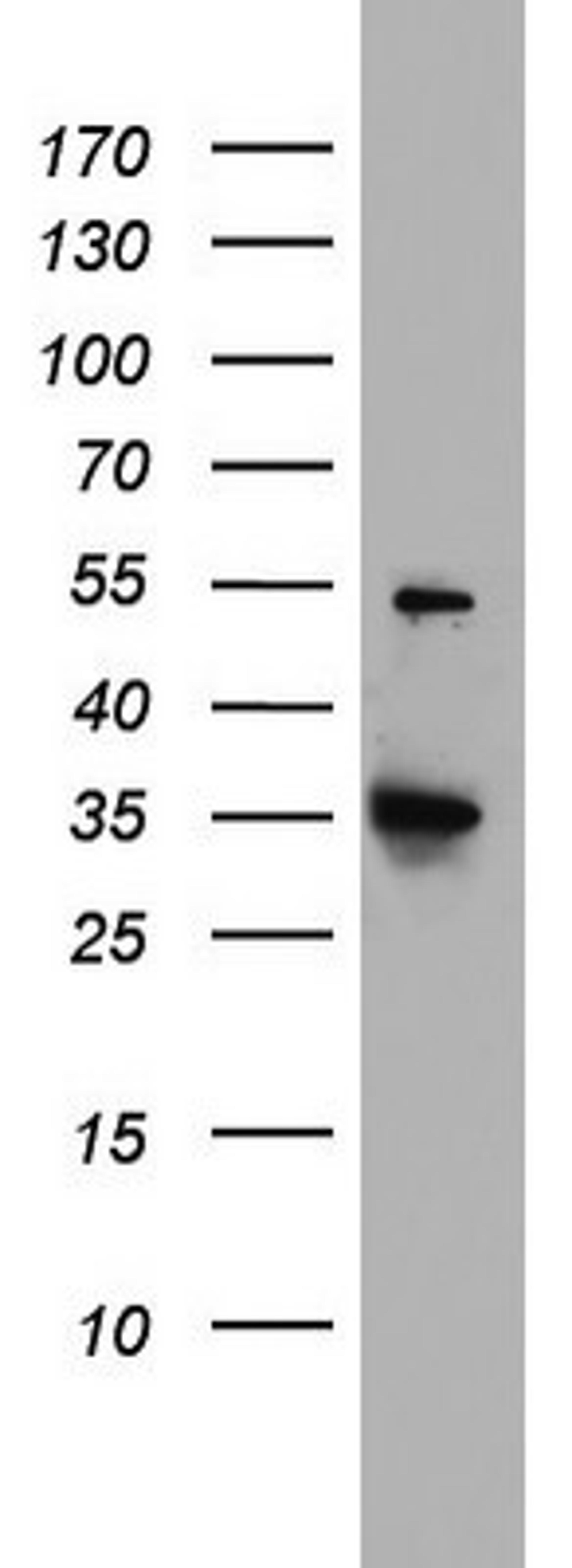 Western Blot: HADH Antibody (3D12) [NBP2-45931] - Analysis of HT29 cell lysate (35ug) by using HADH monoclonal antibody.