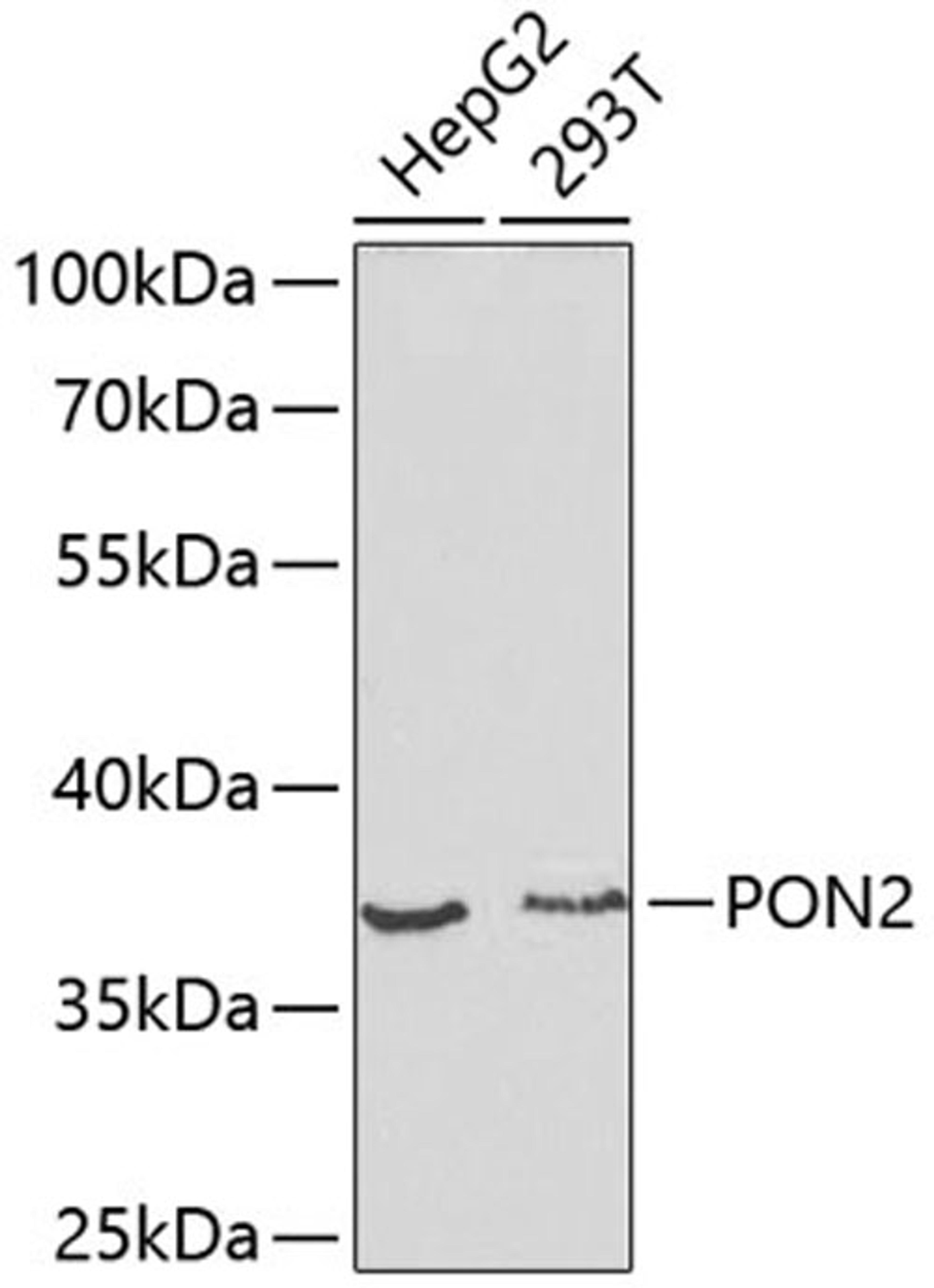 Western blot - PON2 antibody (A1646)