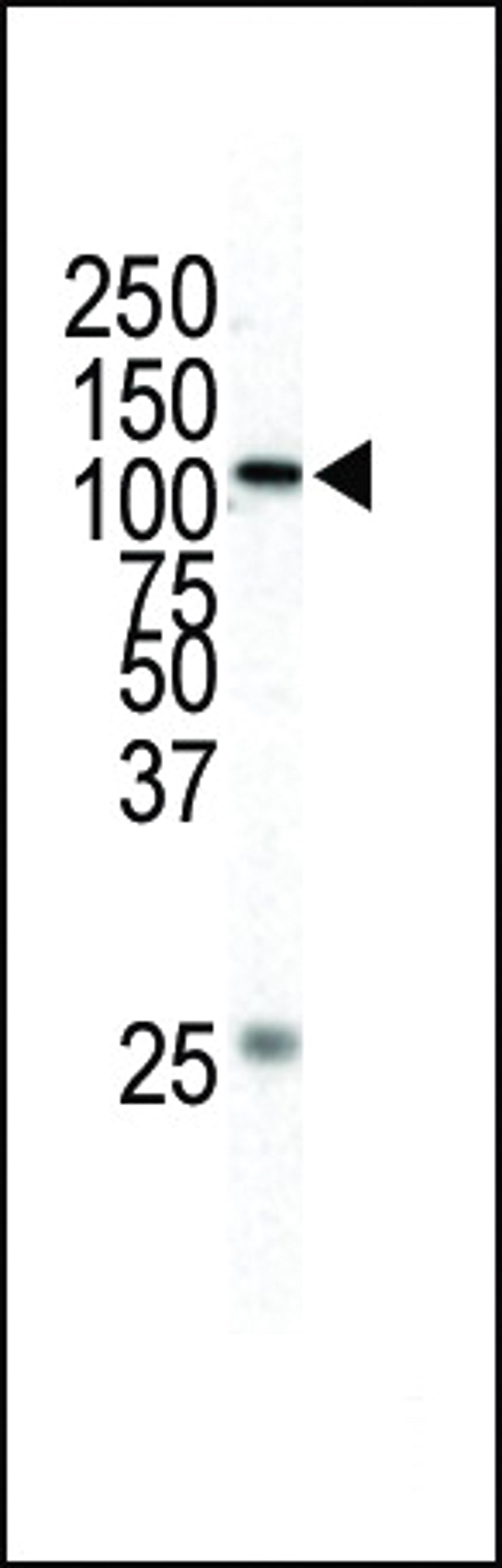 Western blot analysis of anti-MEKK1 Pab in HL-60 cell lysate