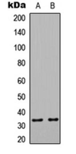 Western blot analysis of HeLa (Lane1), Raw264.7 (Lane2) whole cell using HSPBAP1 antibody