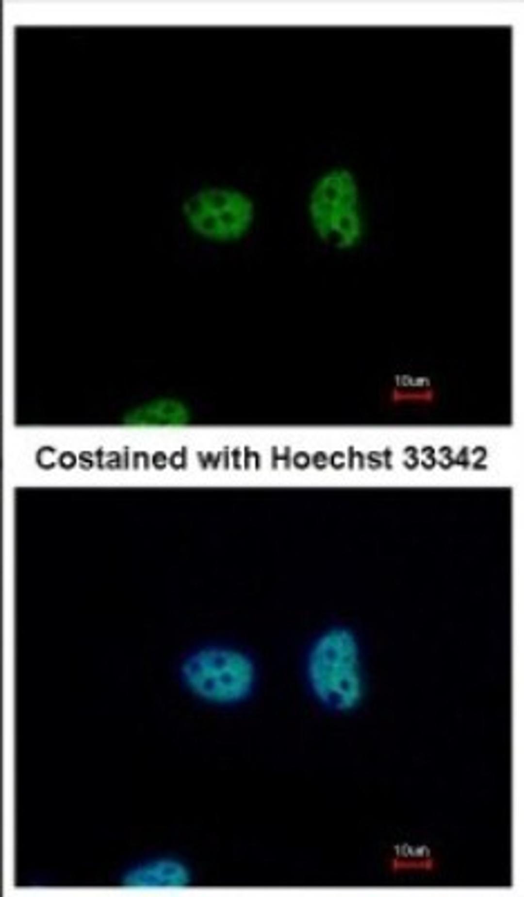 Immunocytochemistry/Immunofluorescence: NFYA Antibody [NBP2-19533] - Immunofluorescence analysis of paraformaldehyde-fixed HeLa, using antibody at 1:500 dilution.