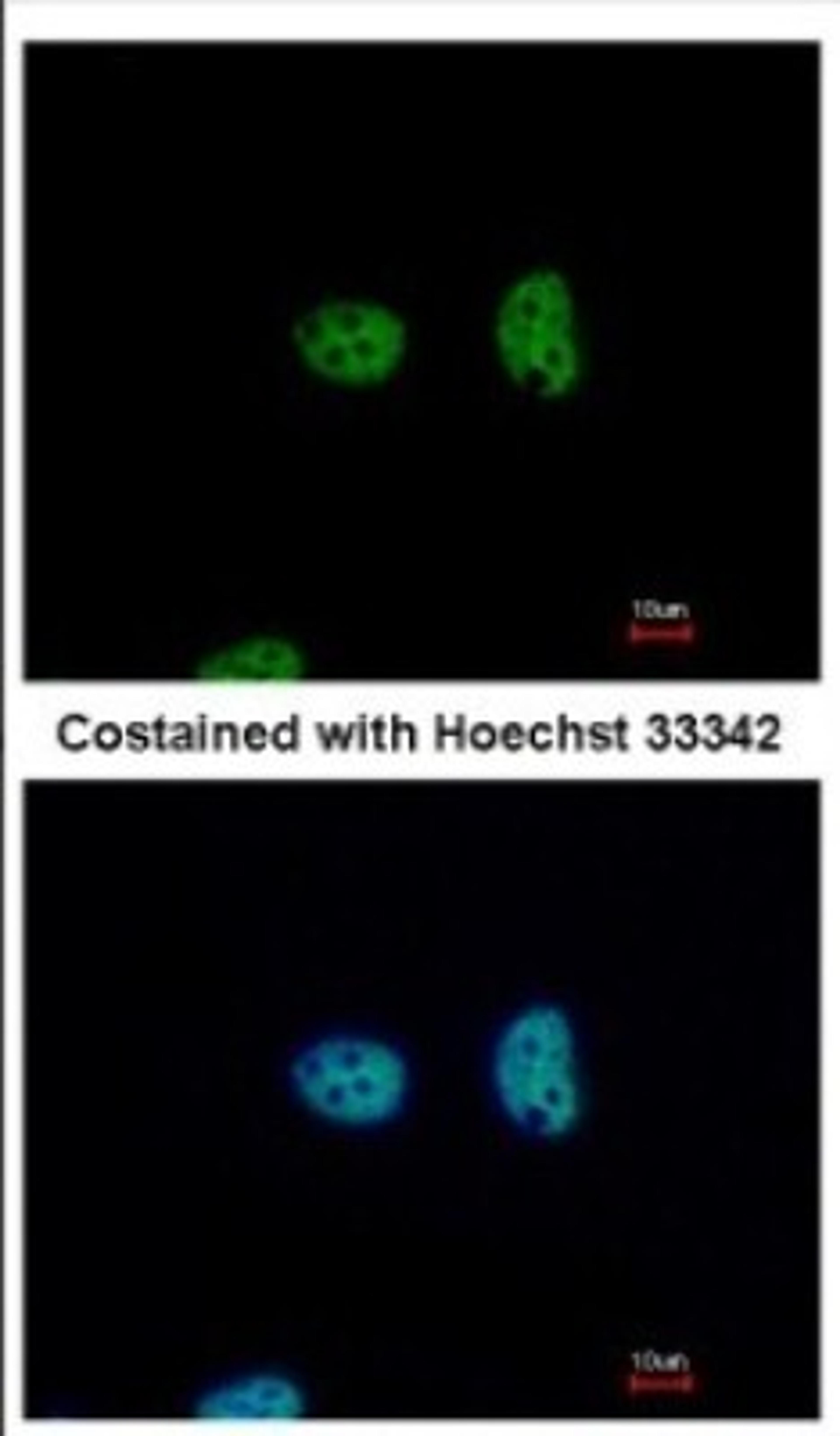 Immunocytochemistry/Immunofluorescence: NFYA Antibody [NBP2-19533] - Immunofluorescence analysis of paraformaldehyde-fixed HeLa, using antibody at 1:500 dilution.